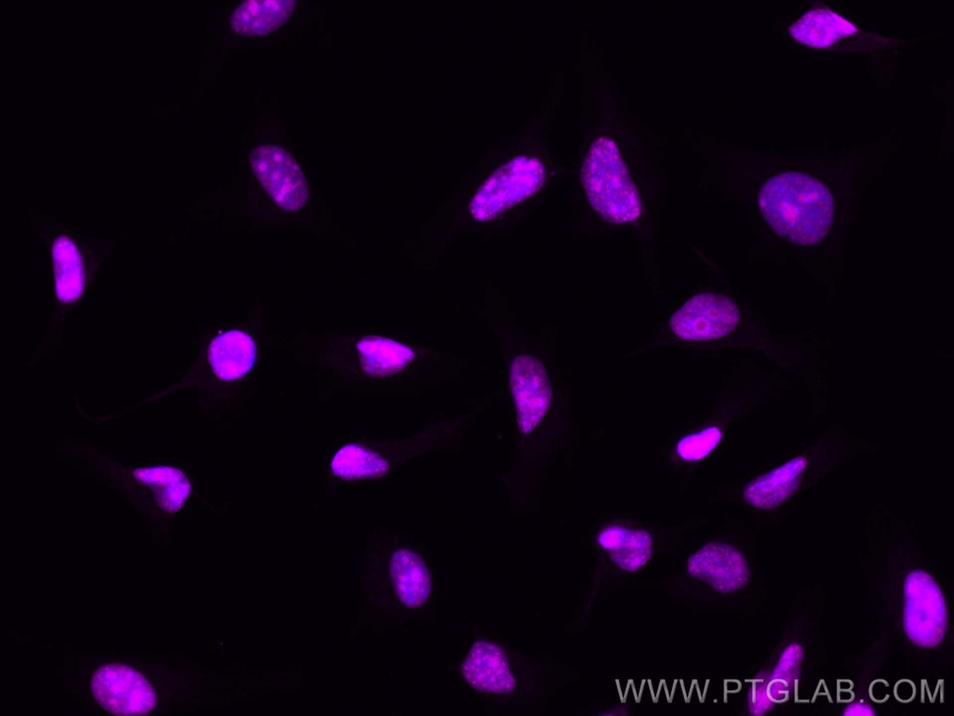 IF Staining of HeLa using CL647-11935