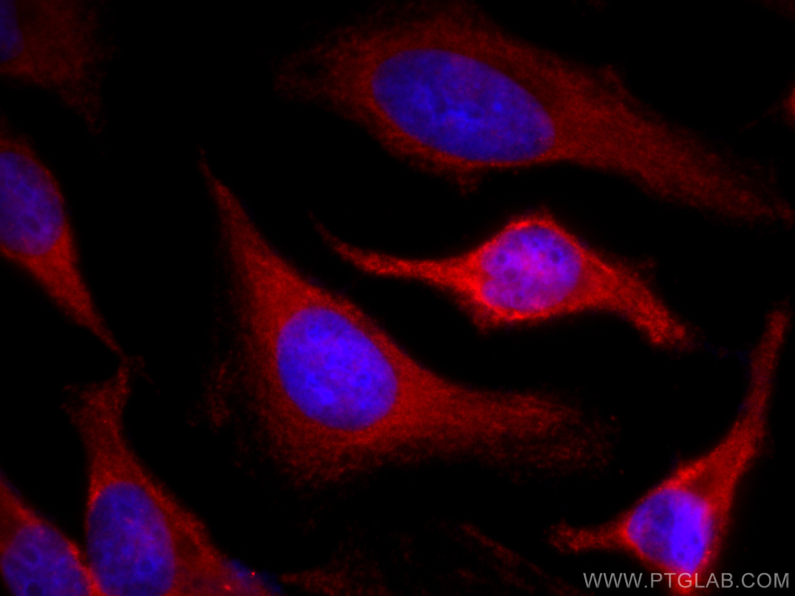 IF Staining of HeLa using CL594-67880