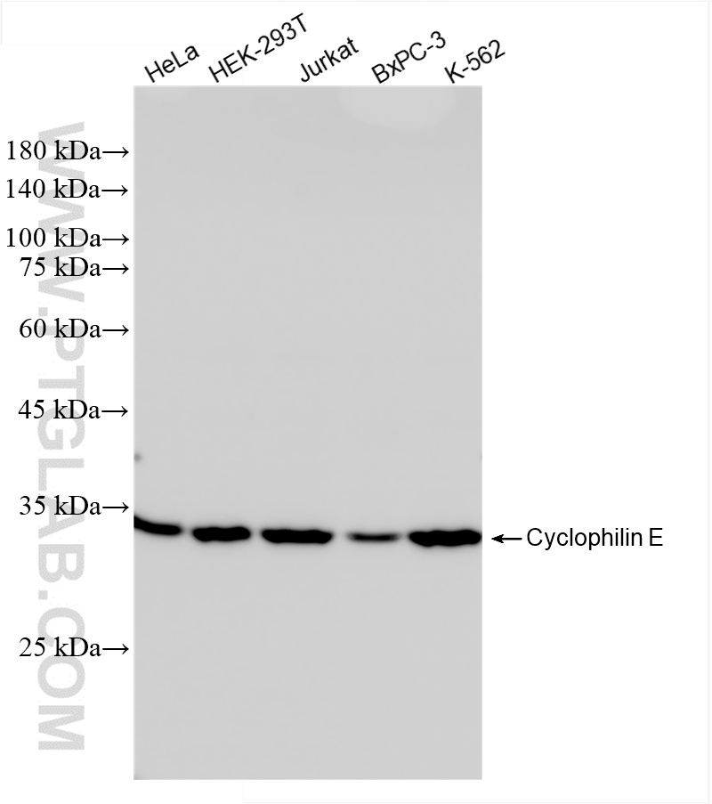 WB analysis using 85952-1-RR (same clone as 85952-1-PBS)
