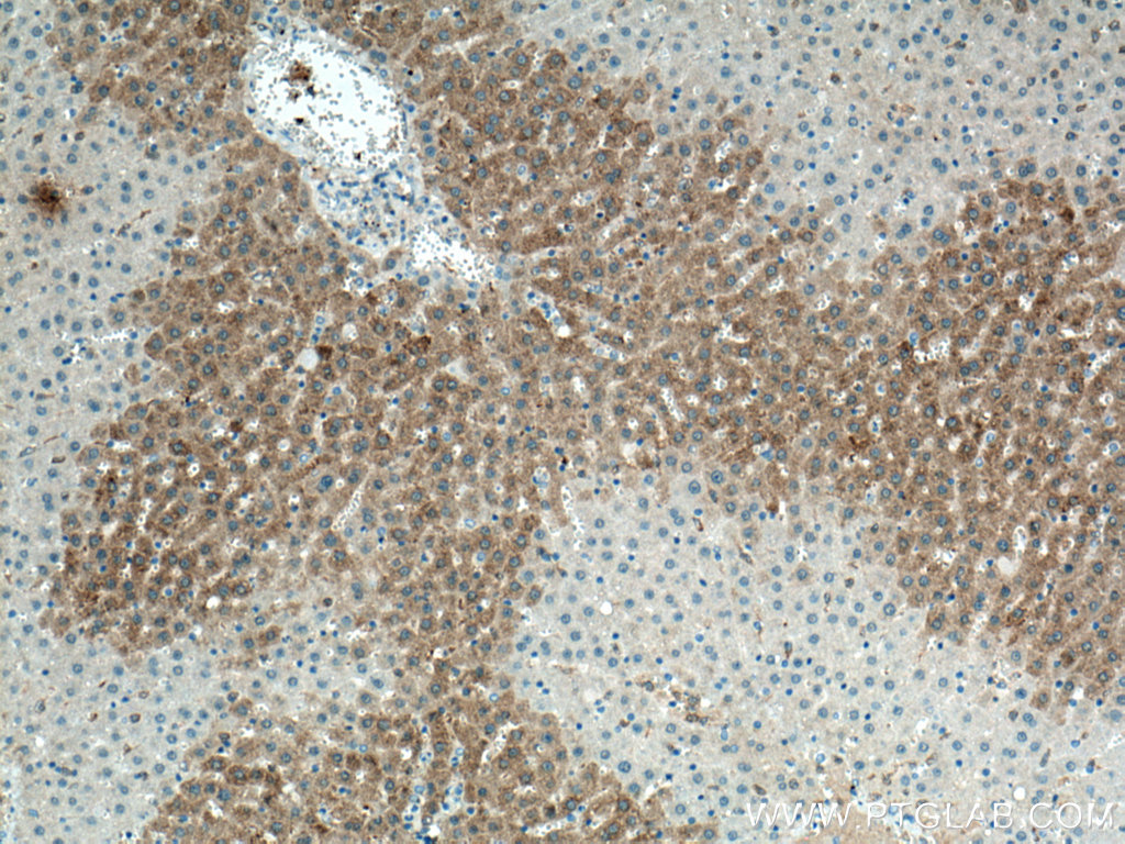 IHC staining of rat liver using 55452-1-AP