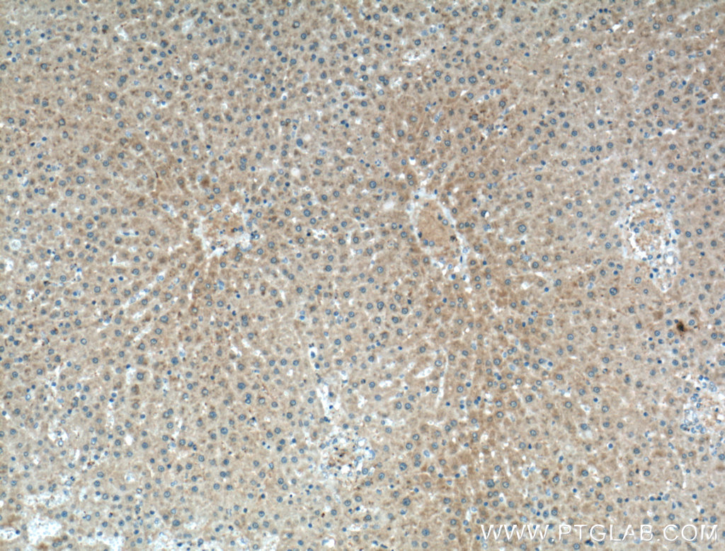 IHC staining of rat liver using 51157-1-AP