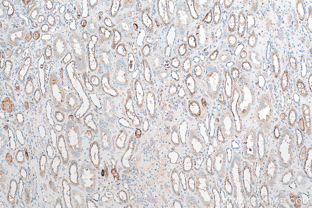 IHC staining of human kidney using 82441-1-RR