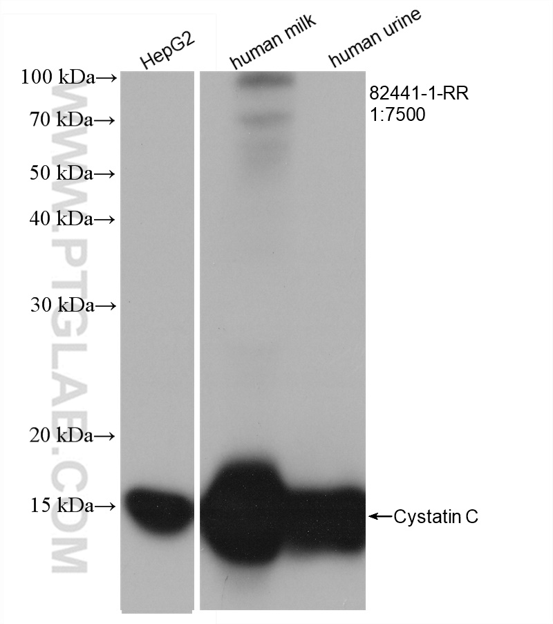 WB analysis using 82441-1-RR