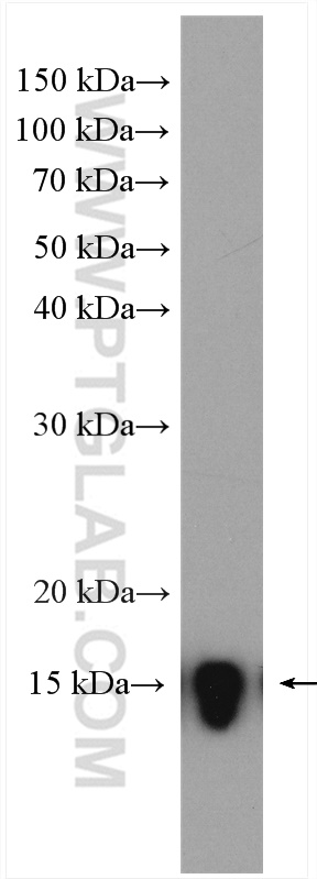 WB analysis of human saliva using 26979-1-AP