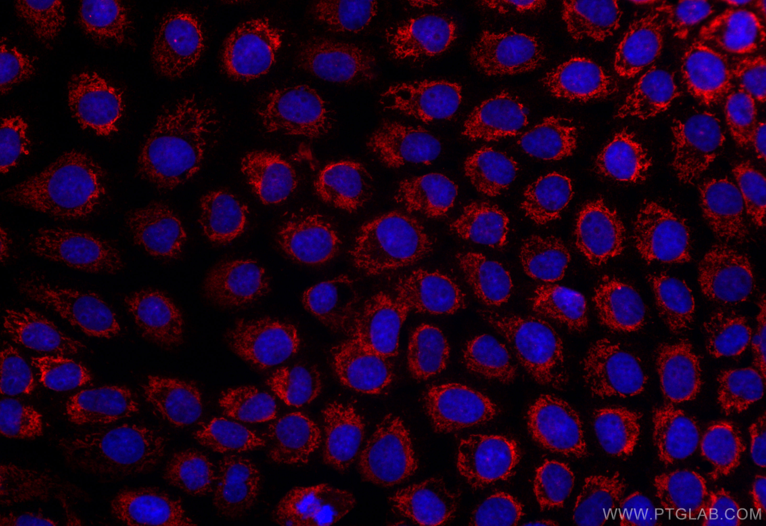 IF Staining of A431 using CL594-83276