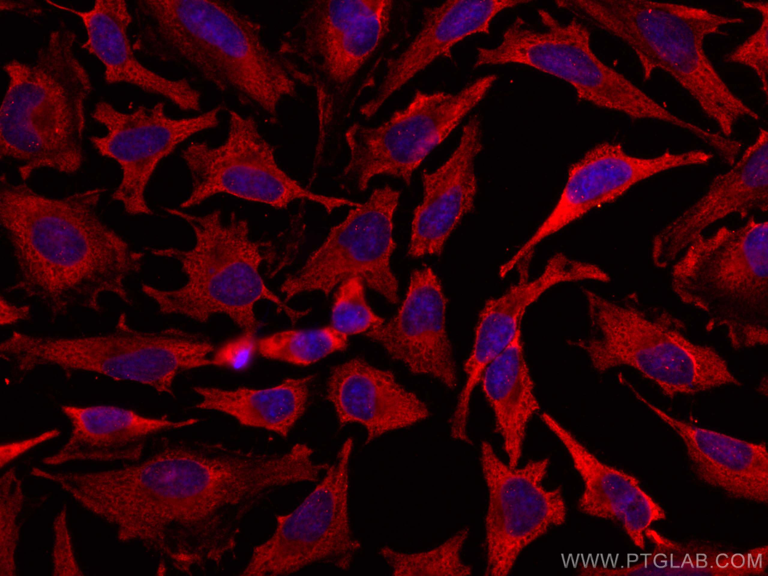 IF Staining of HeLa using CL594-60228
