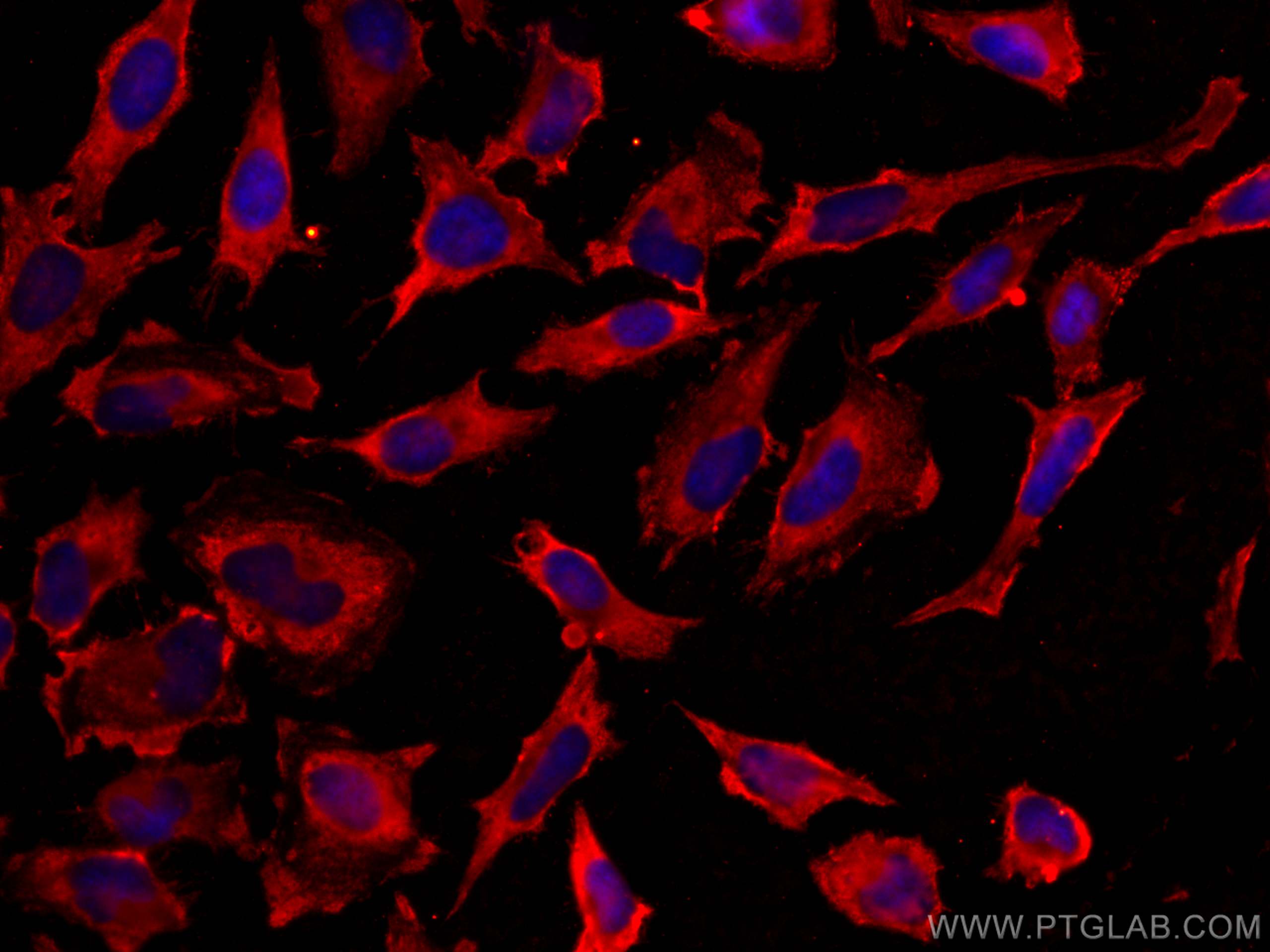 IF Staining of HeLa using CL594-60228