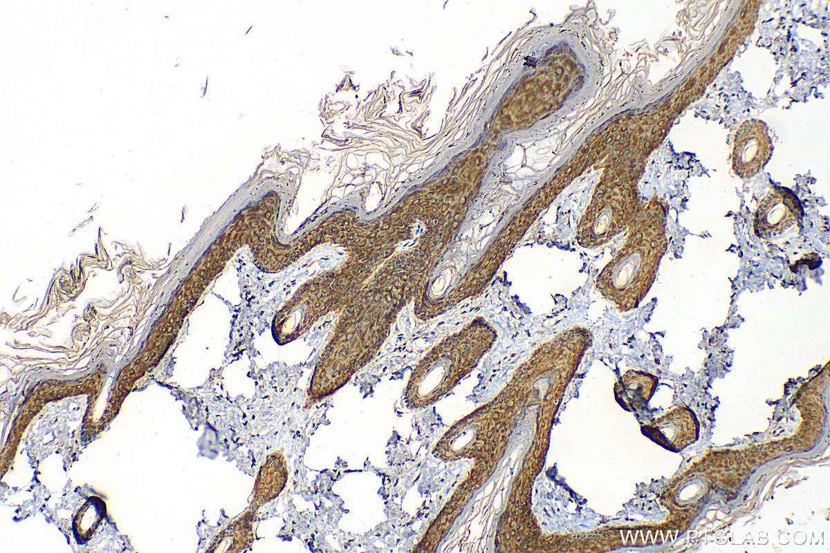 Immunohistochemical analysis of paraffin-embedded rat skin tissue slide using 82972-4-RR (Cytokeratin 1-specific antibody) at dilution of 1:1000 (under 10x lens). Heat mediated antigen retrieval with Tris-EDTA buffer (pH 9.0). IHC staining of rat skin using 82972-4-RR