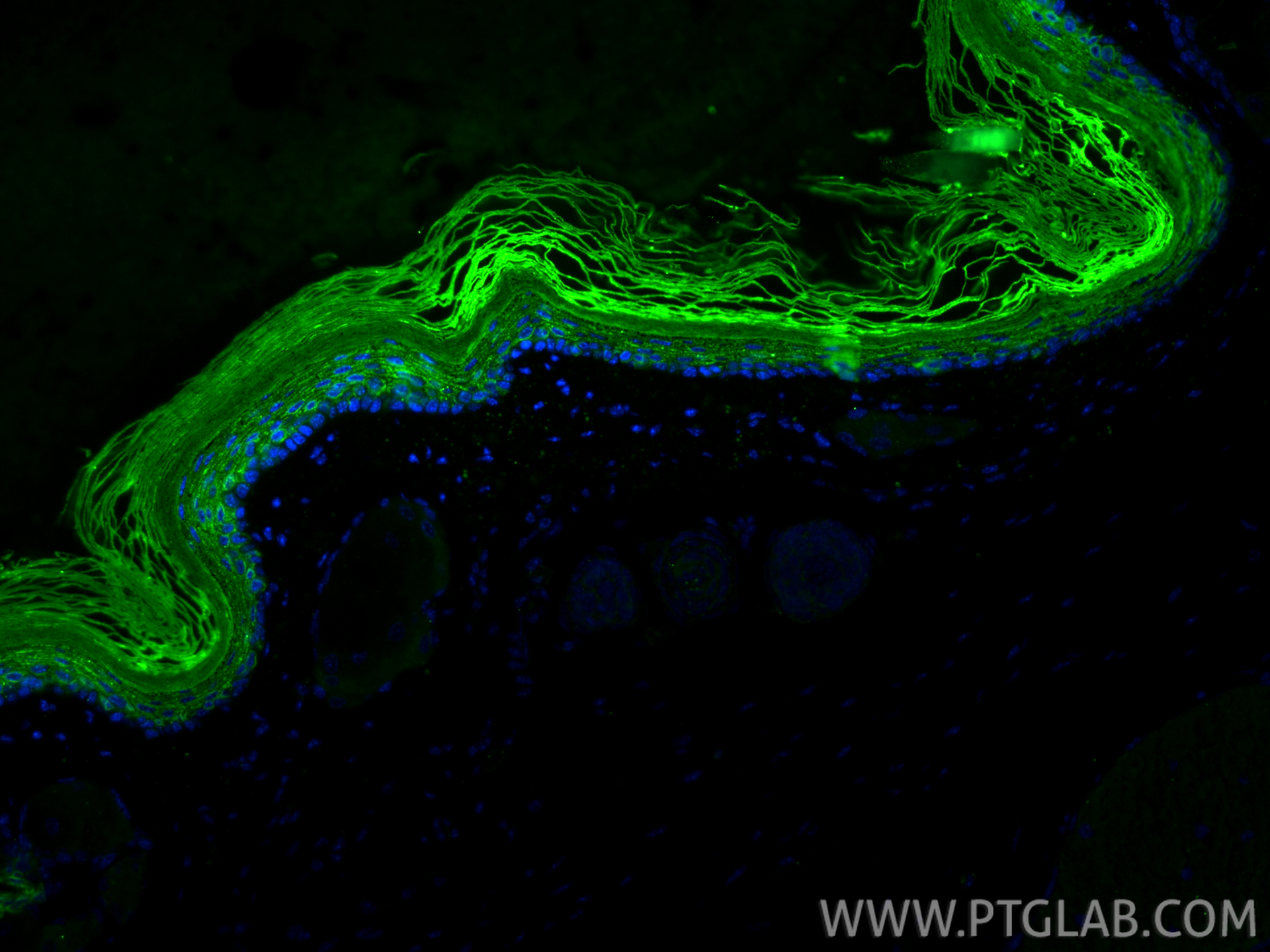 IF Staining of mouse skin using 86324-1-RR