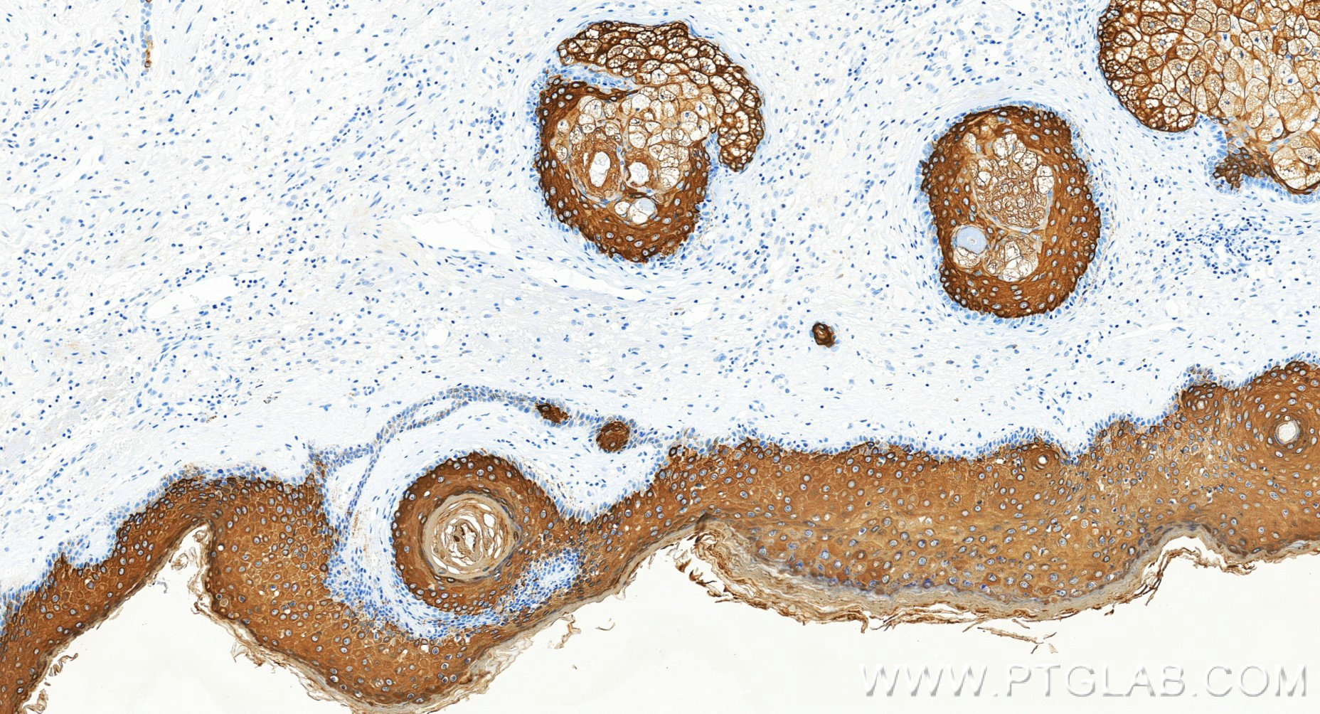 IHC staining of human skin using 86324-1-RR