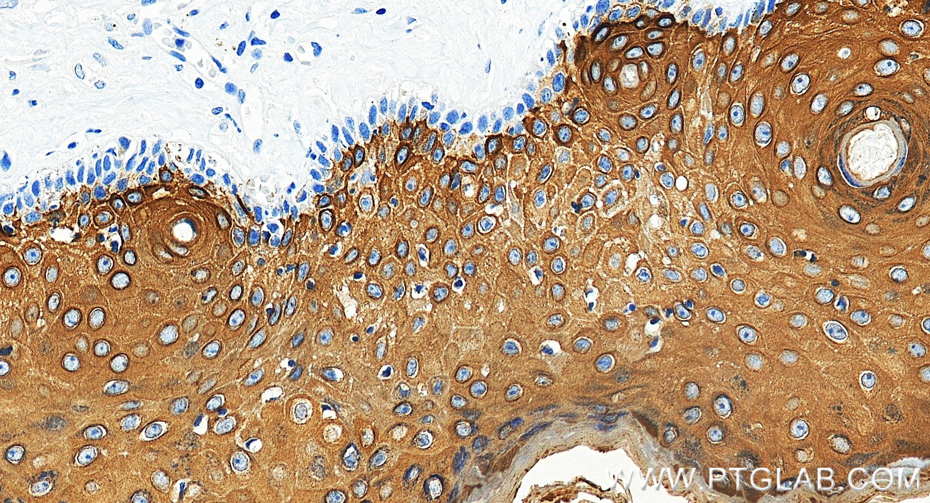 IHC staining of human skin using 86324-1-RR