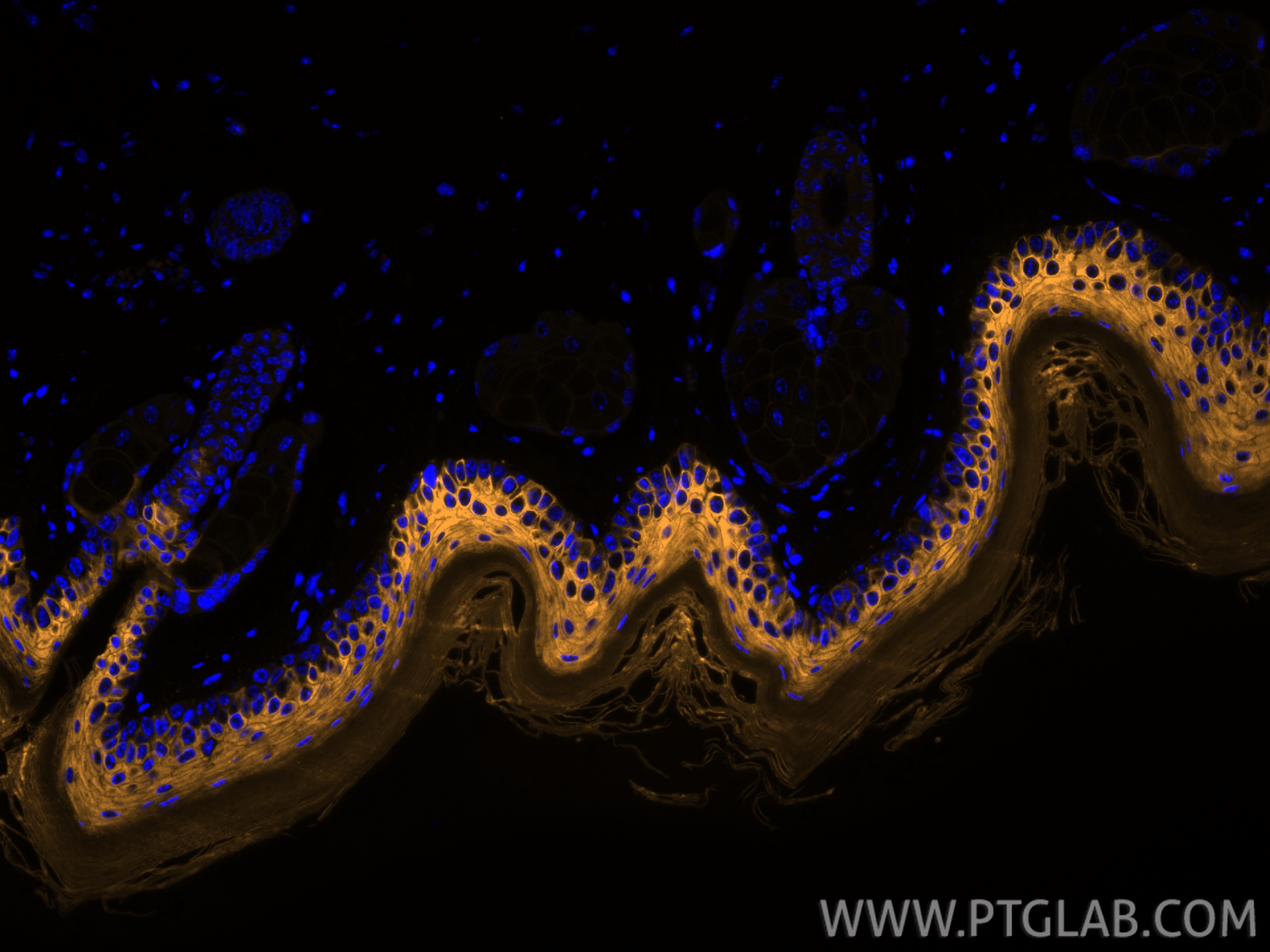 IF Staining of mouse skin using CL555-18343