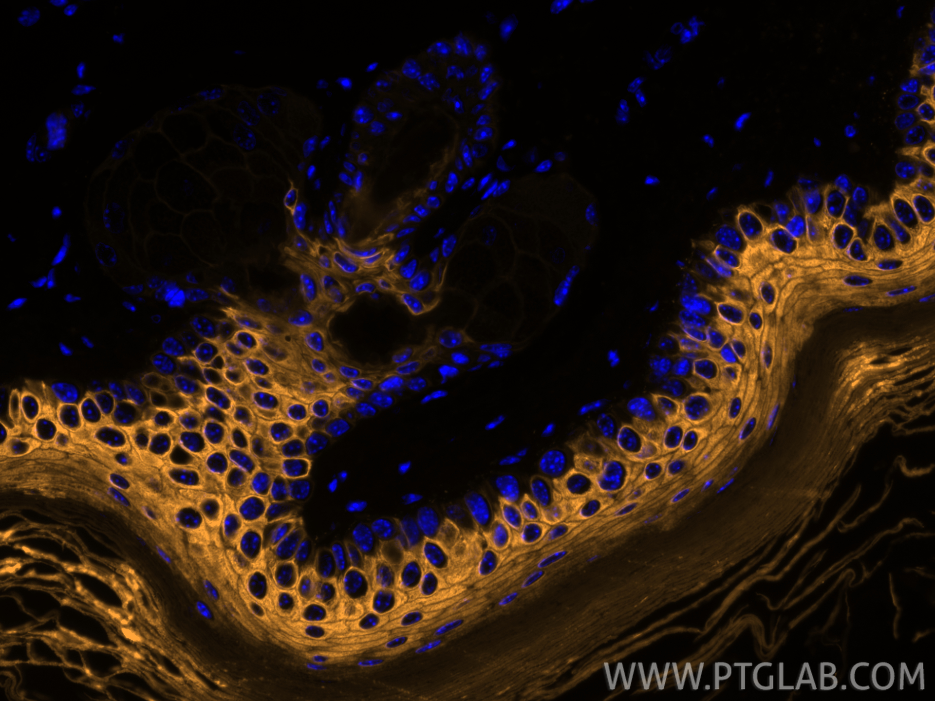 IF Staining of mouse skin using CL555-18343