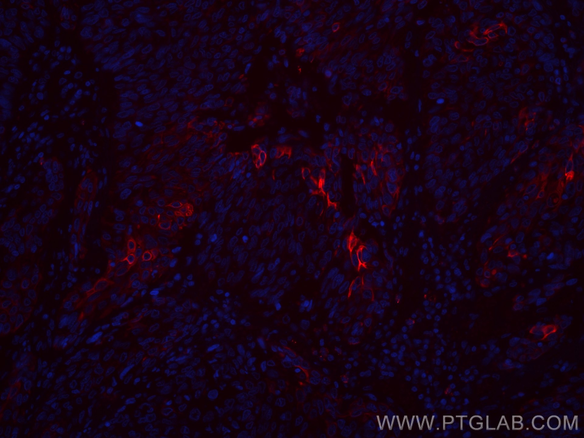 Cytokeratin 13