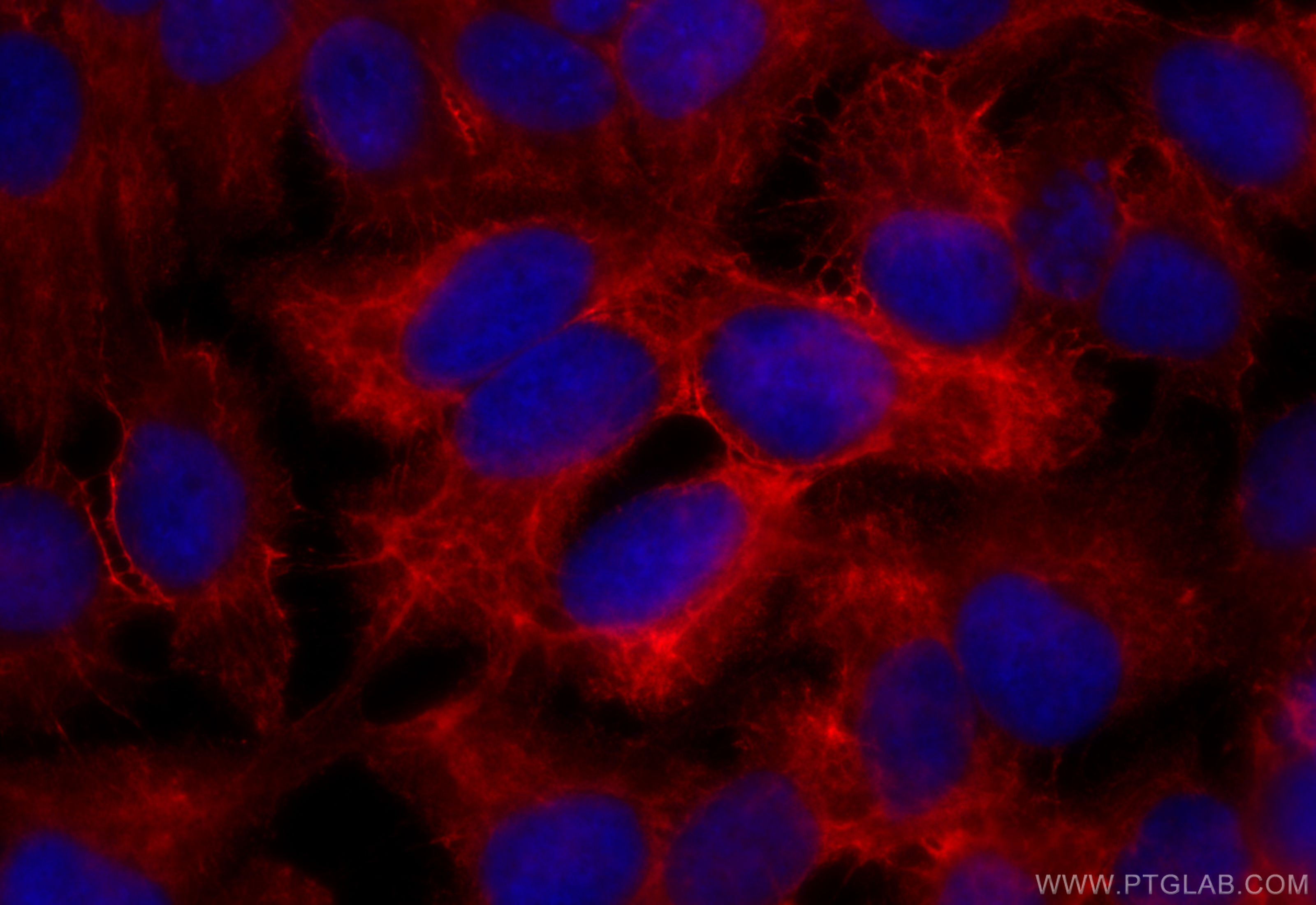 IF Staining of HaCaT using CL594-66684