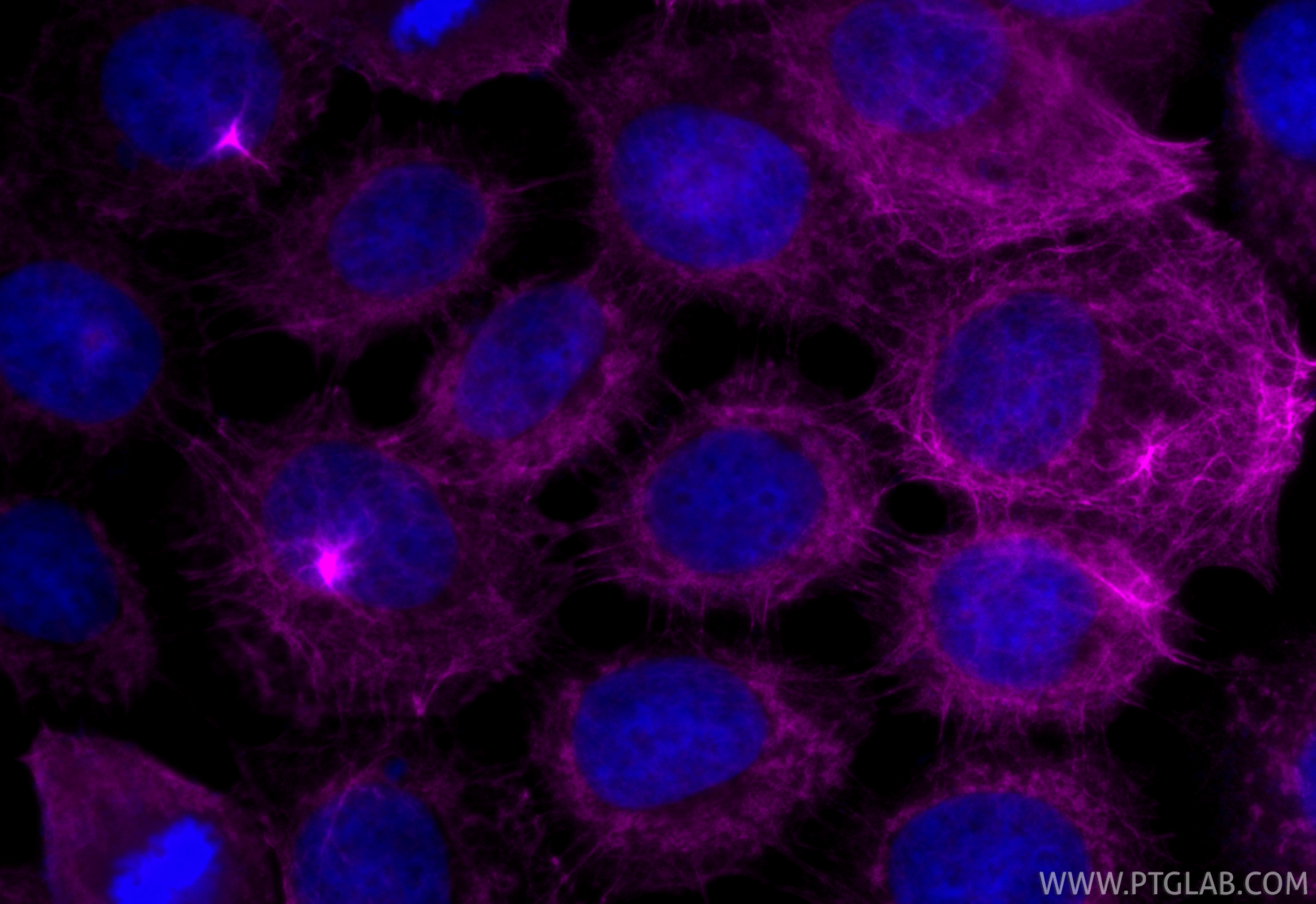 IF Staining of A431 using CL647-10164 IF Staining of A431 using CL647-10164