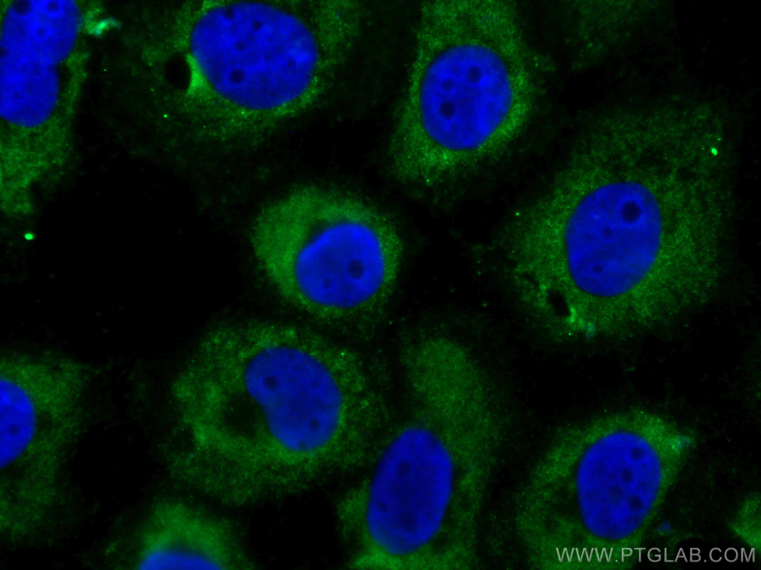 Cytokeratin 14