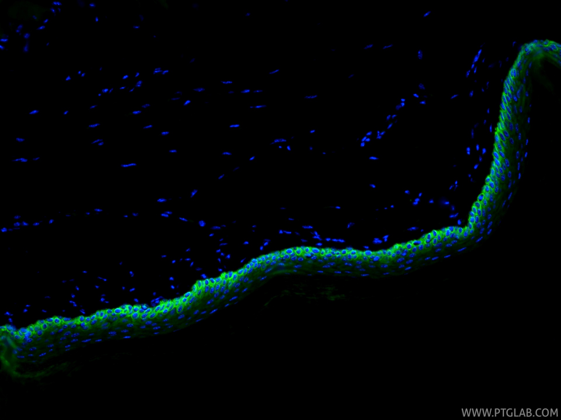 Immunofluorescent analysis of (4% PFA) fixed paraffin-embedded mouse skin tissue using CoraLite® Plus 488 Cytokeratin 14 antibody (CL488-82824, Clone: 1L19 ) at dilution of 1:200. Heat mediated antigen retrieval with Tris-EDTA buffer (pH 9.0). IF Staining of mouse skin using CL488-82824