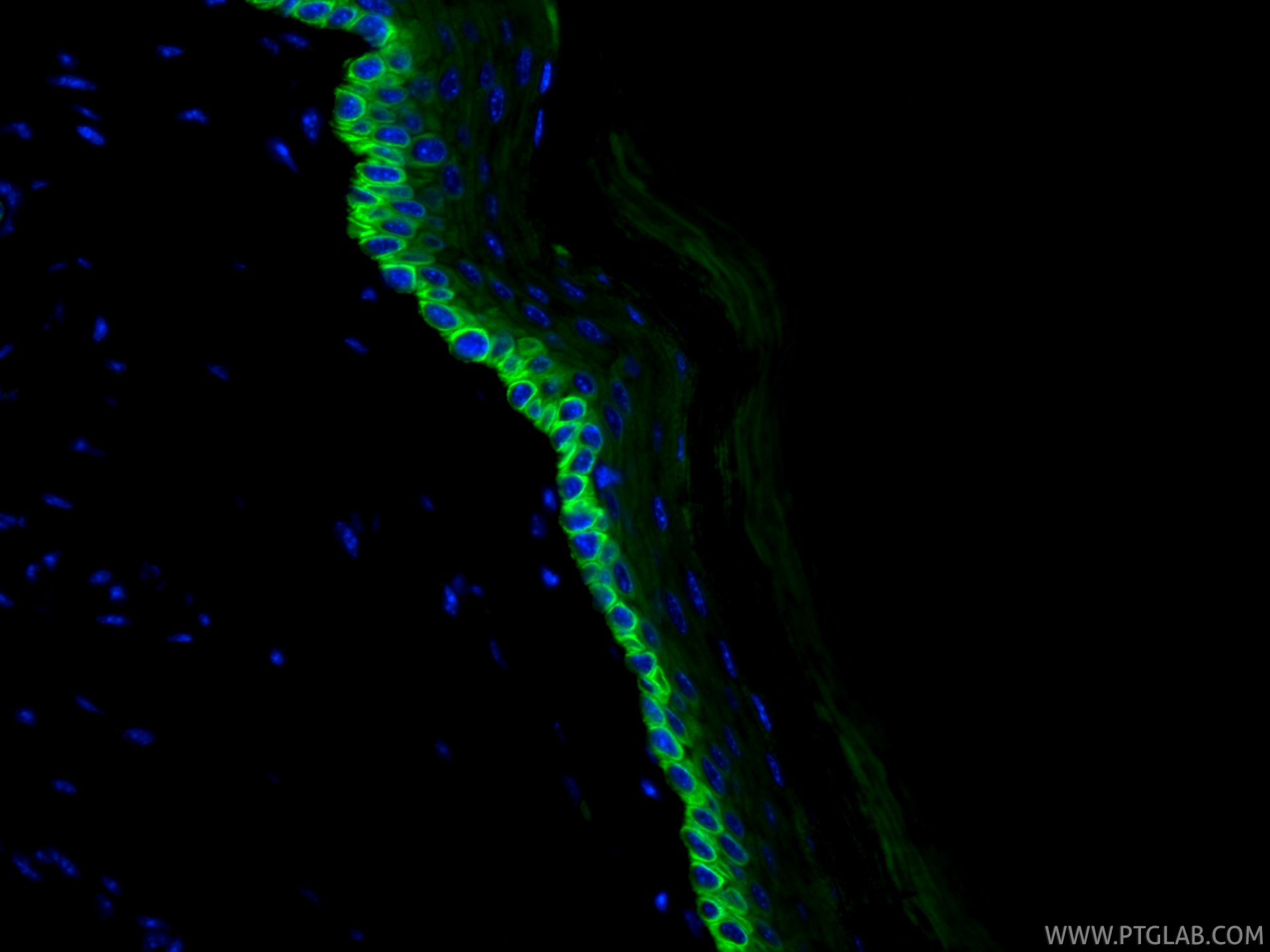 Immunofluorescent analysis of (4% PFA) fixed paraffin-embedded mouse skin tissue using CoraLite® Plus 488 Cytokeratin 14 antibody (CL488-82824, Clone: 1L19 ) at dilution of 1:200. Heat mediated antigen retrieval with Tris-EDTA buffer (pH 9.0). IF Staining of mouse skin using CL488-82824