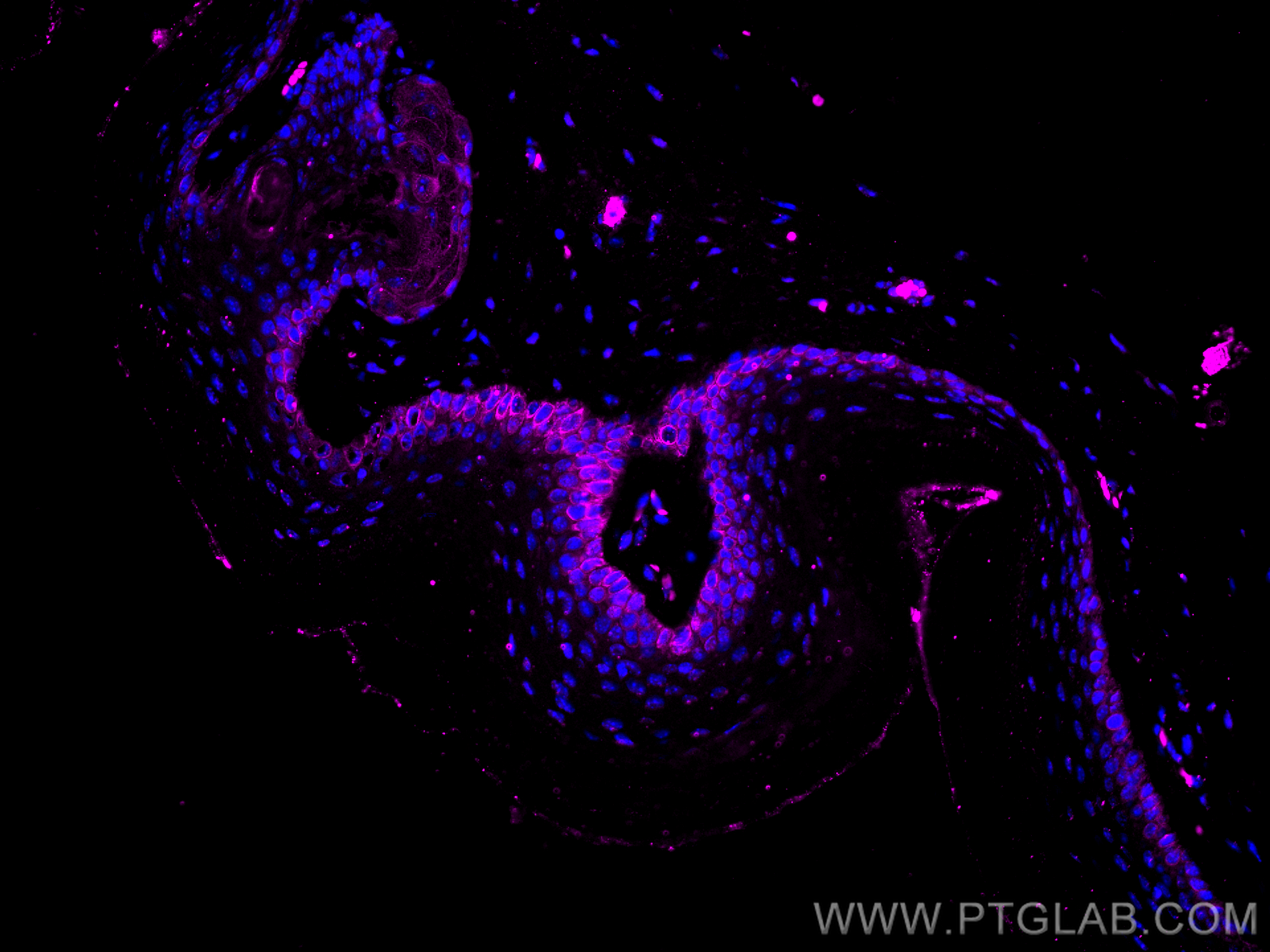 IF Staining of mouse skin using CL647-60320