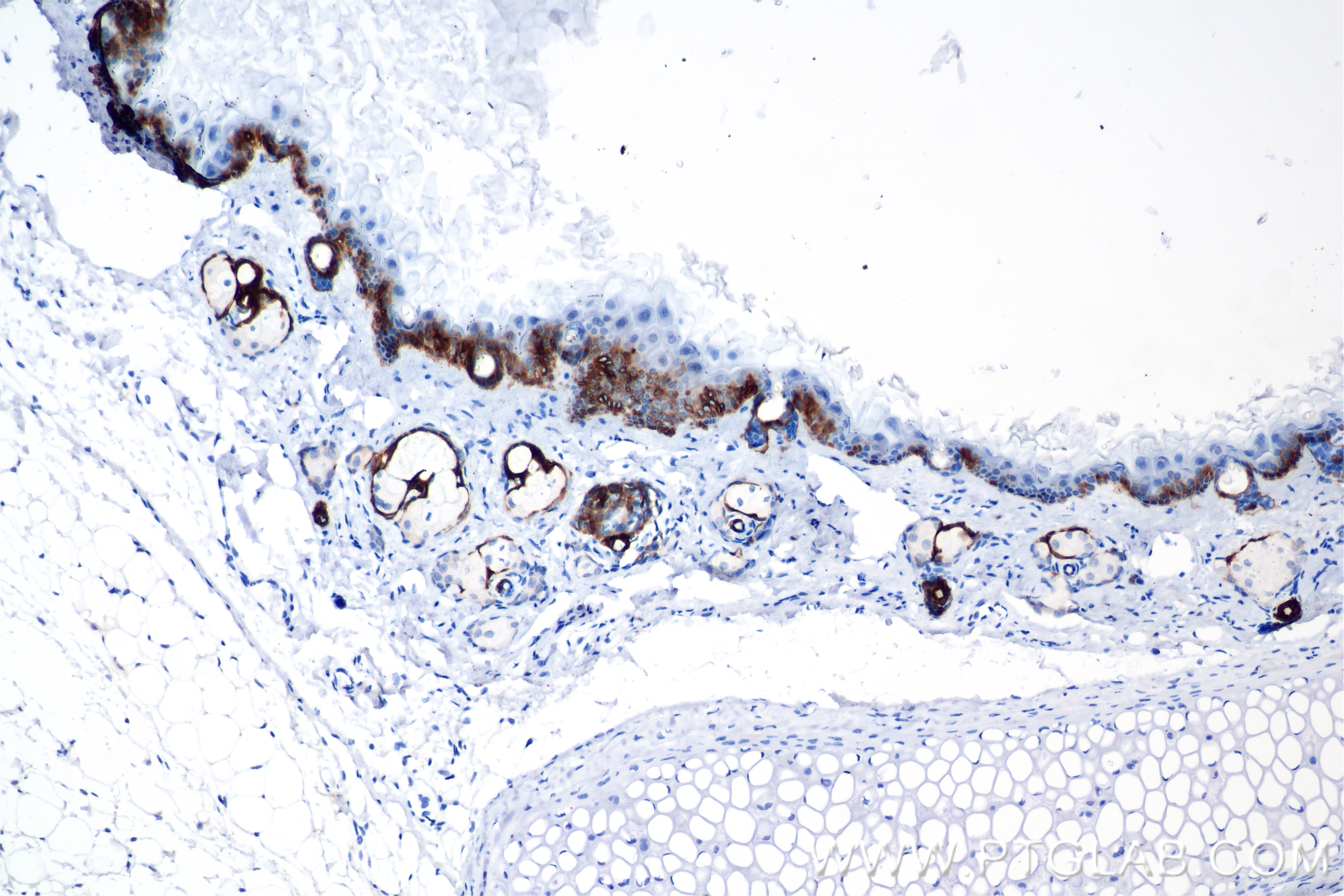 IHC staining of mouse skin using 86761-3-RR (same clone as 86761-3-PBS) IHC staining of mouse skin using 86761-3-RR (same clone as 86761-3-PBS)
