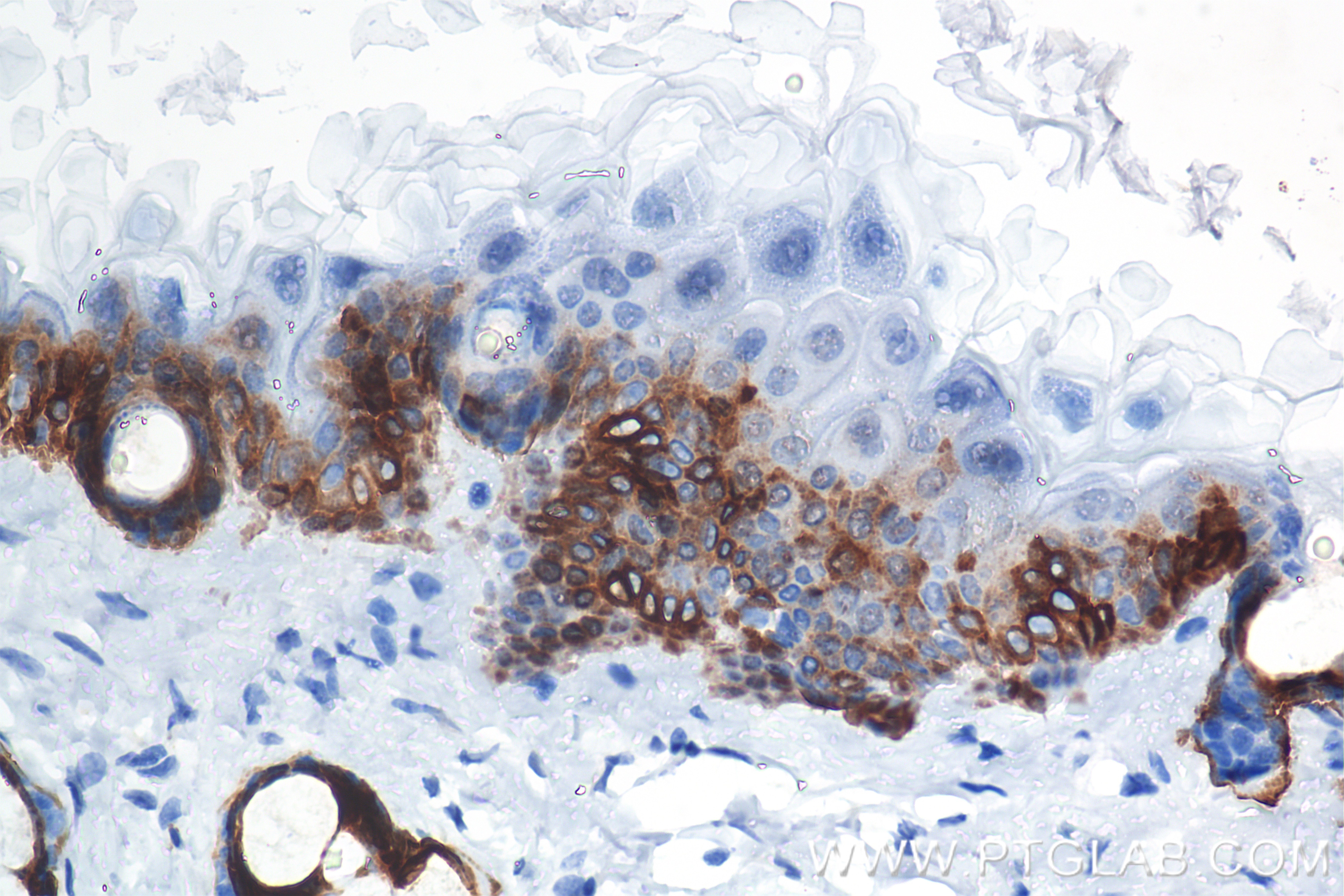IHC staining of mouse skin using 86761-3-RR (same clone as 86761-3-PBS) IHC staining of mouse skin using 86761-3-RR (same clone as 86761-3-PBS)