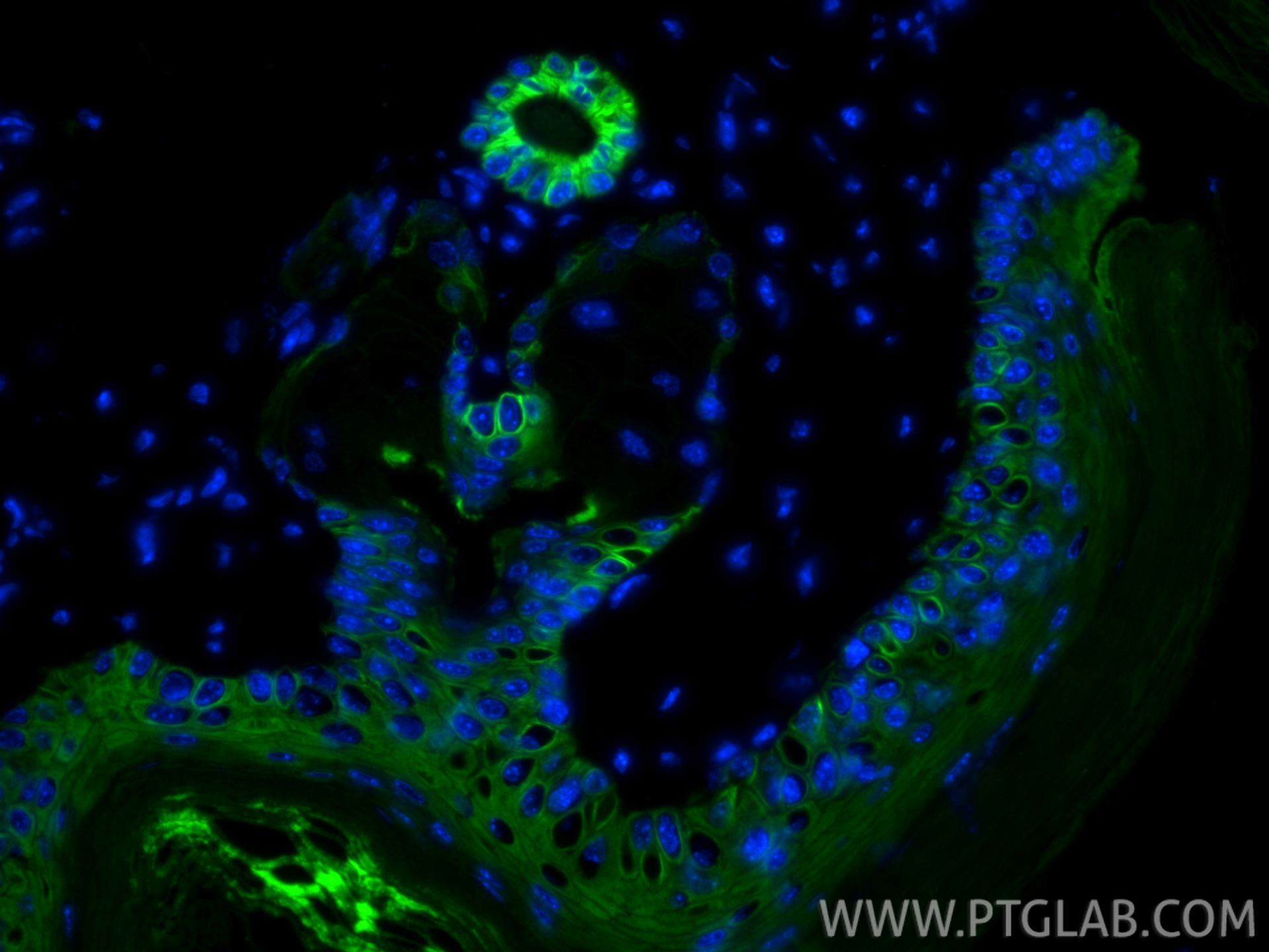 Immunofluorescent analysis of (4% PFA) fixed paraffin-embedded mouse skin tissue using CoraLite® Plus 488 Cytokeratin 15 antibody (CL488-60247, Clone: 6B4F8 ) at dilution of 1:200. Heat mediated antigen retrieval with Tris-EDTA buffer (pH 9.0). IF Staining of mouse skin using CL488-60247