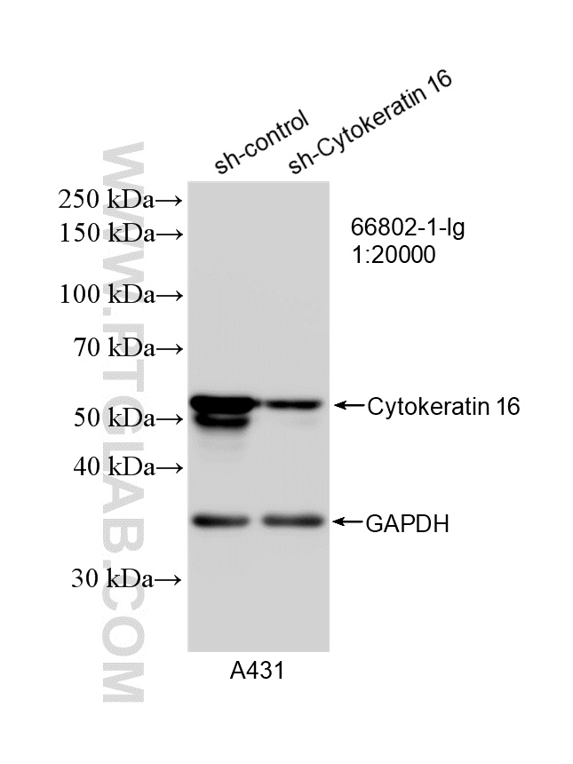 WB analysis of A431 using 66802-1-Ig WB analysis of A431 using 66802-1-Ig
