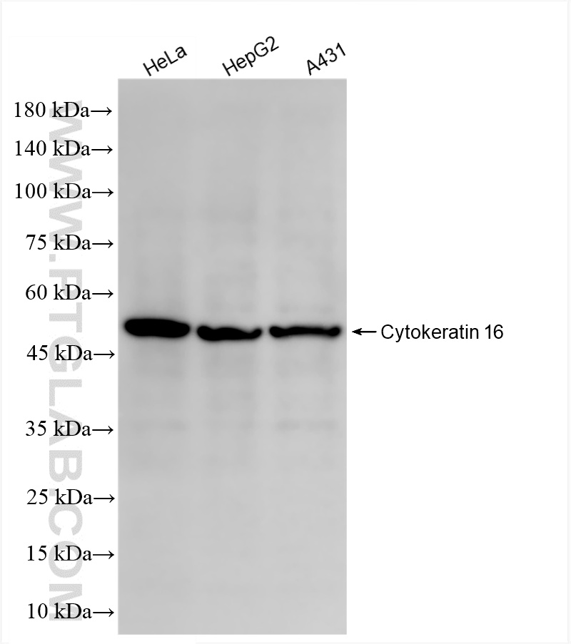 WB analysis using 86235-1-RR