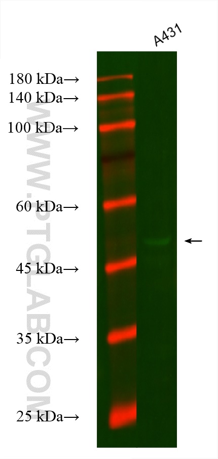 Cytokeratin 16