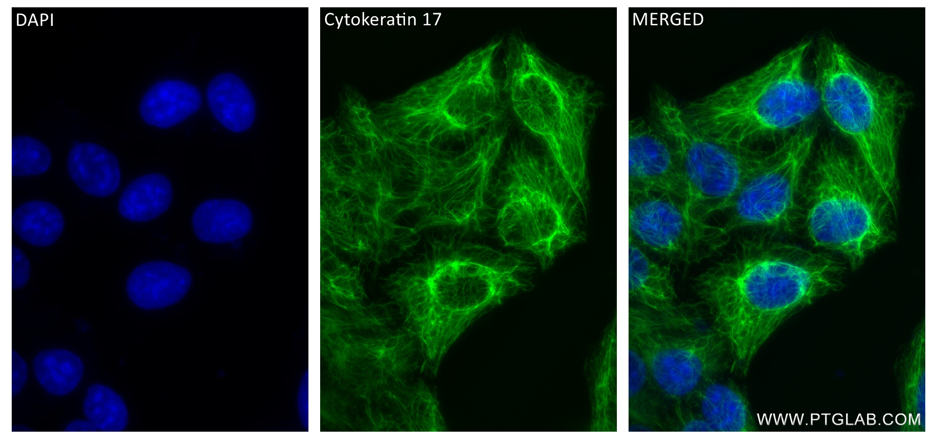 IF Staining of HeLa using 84978-1-RR