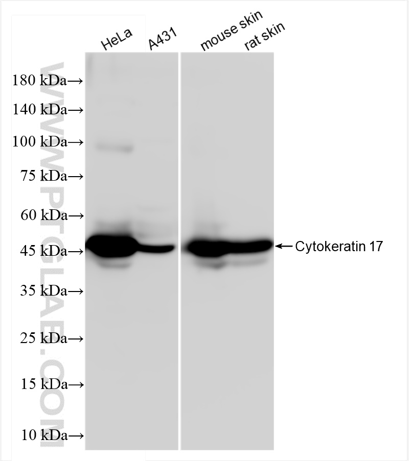 WB analysis using 84978-1-RR