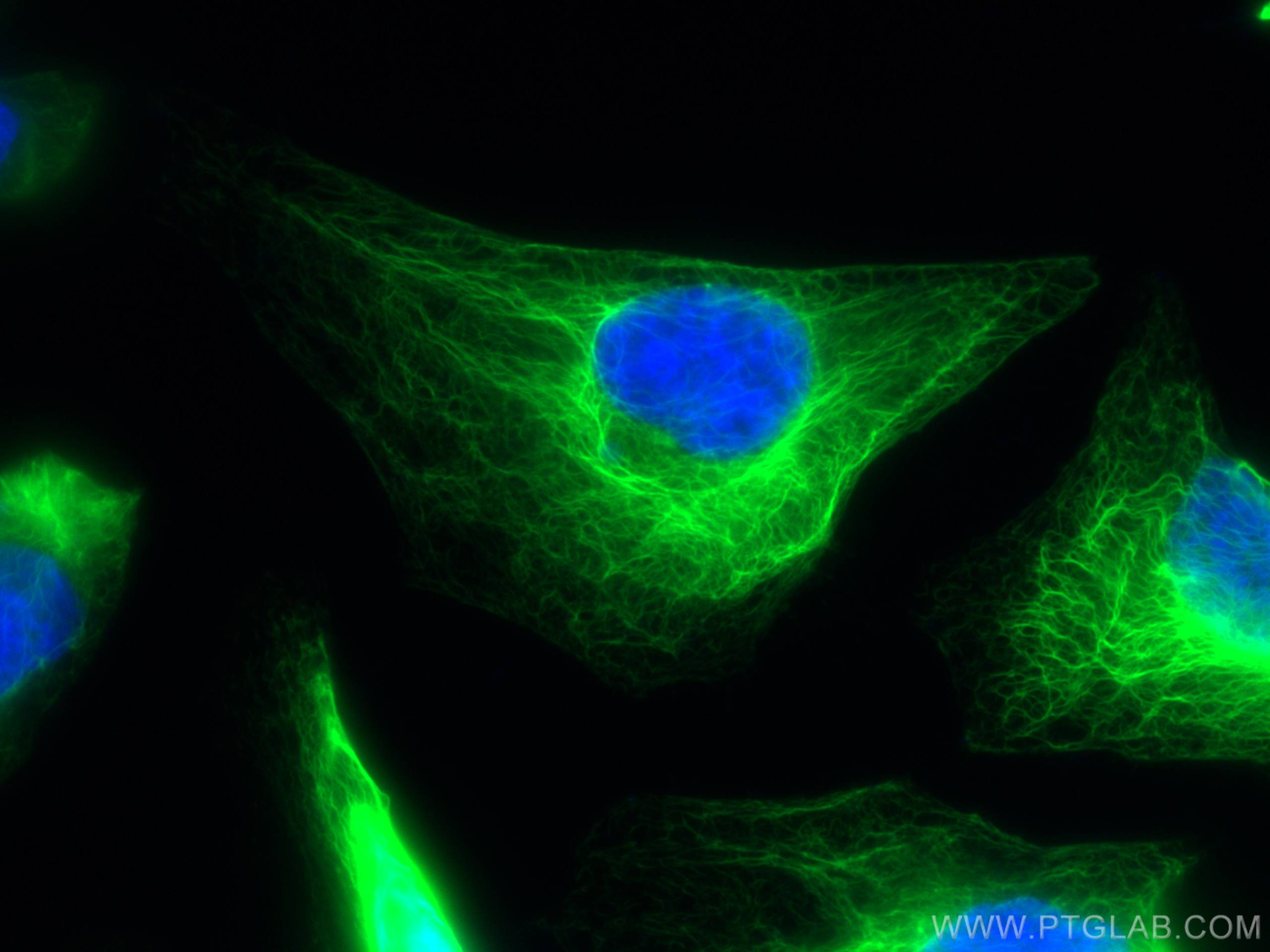 Cytokeratin 17-Specific