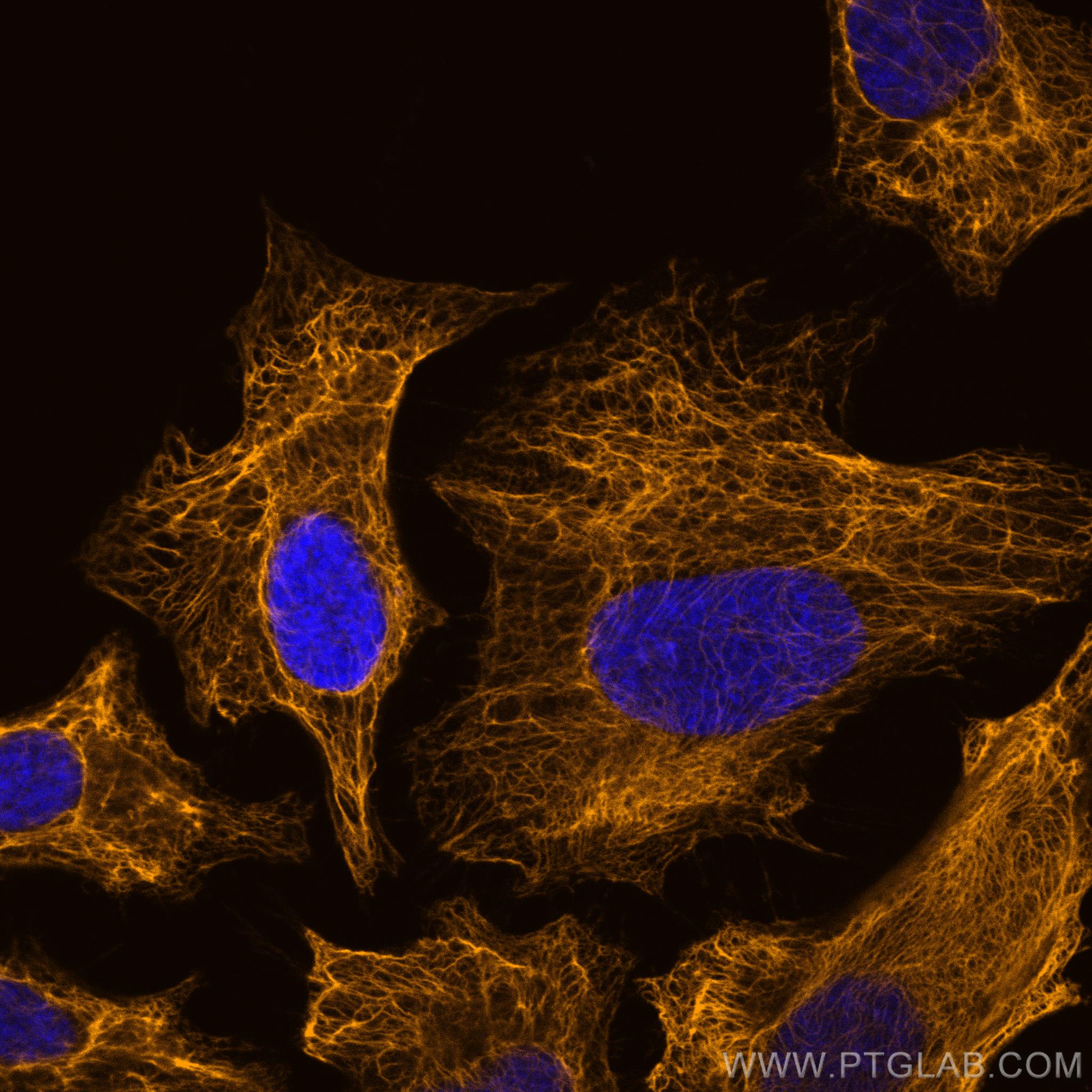 IF Staining of HeLa using CL555-17516
