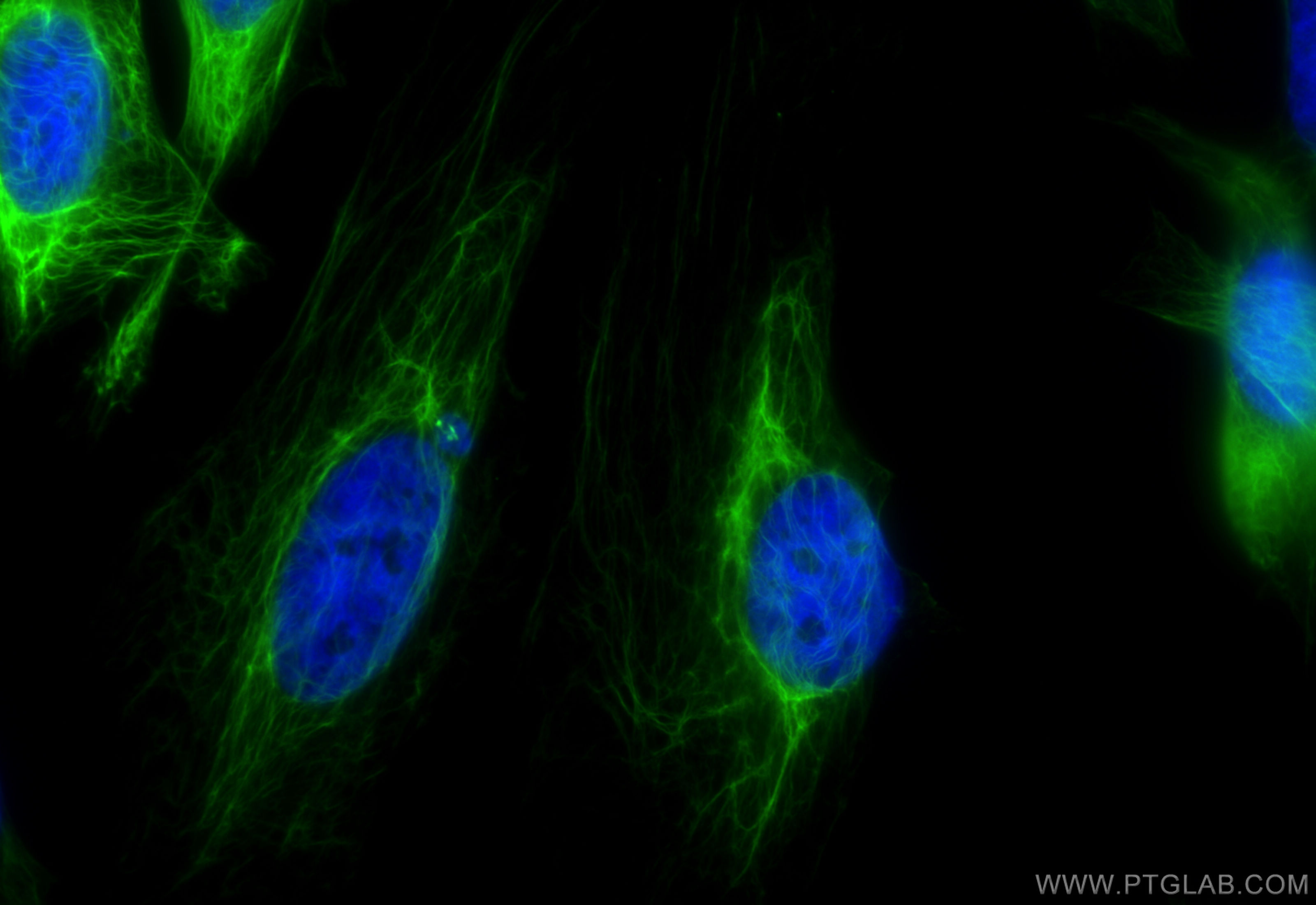 IF Staining of HeLa using CL488-84978