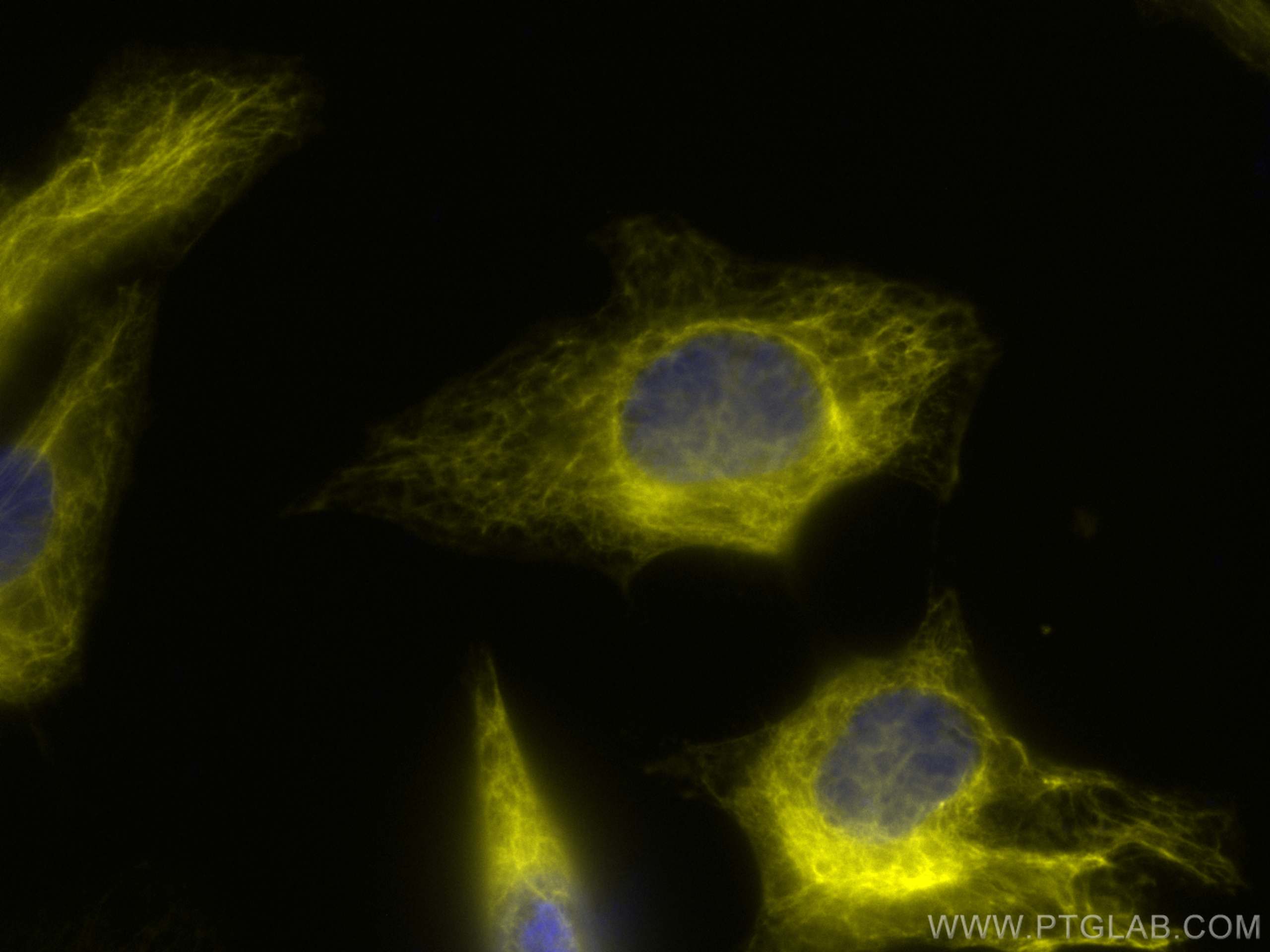 IF Staining of HeLa using CL532-66187