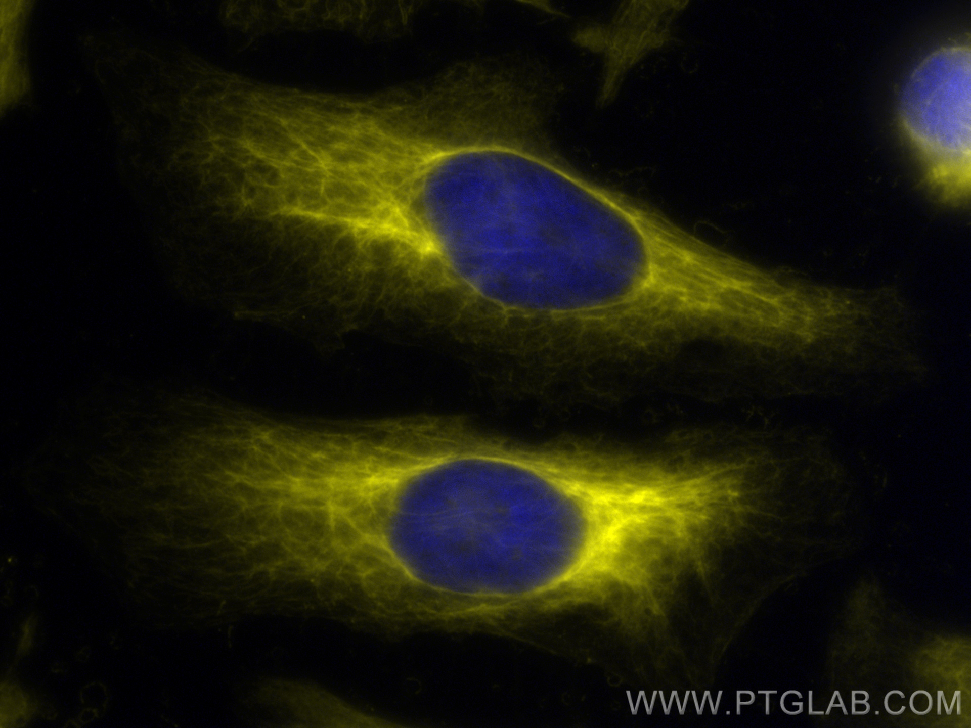 IF Staining of HeLa using CL532-66187