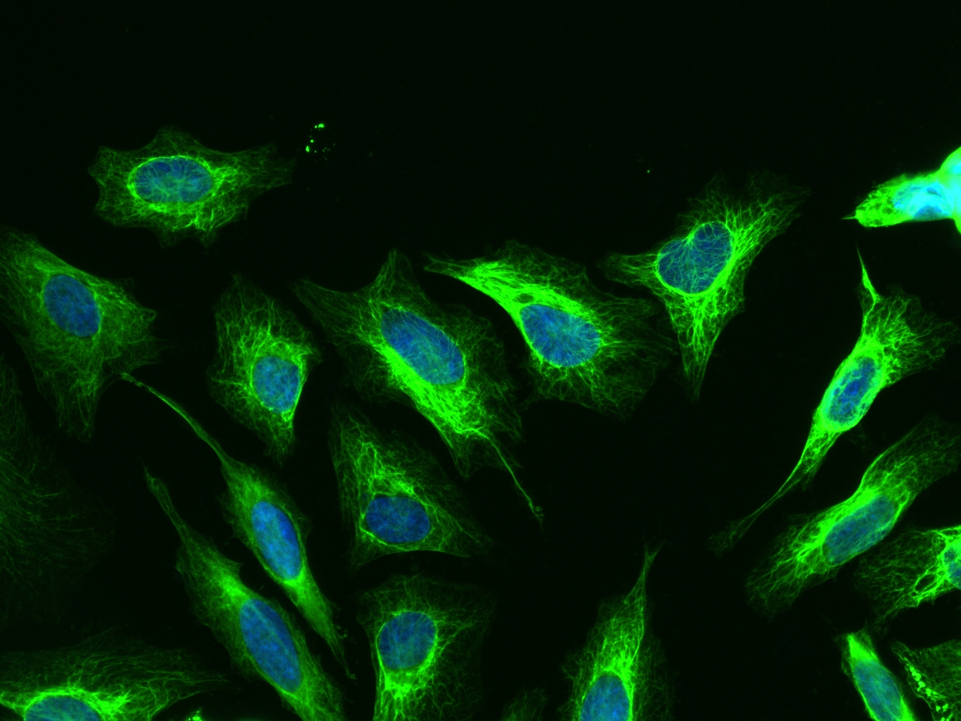 IF Staining of HeLa using FITC-66187