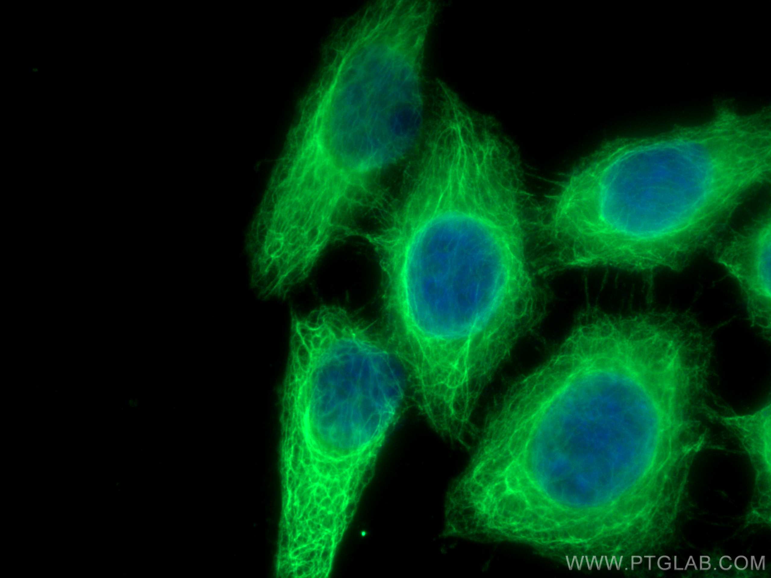 IF Staining of HepG2 using 29855-1-AP