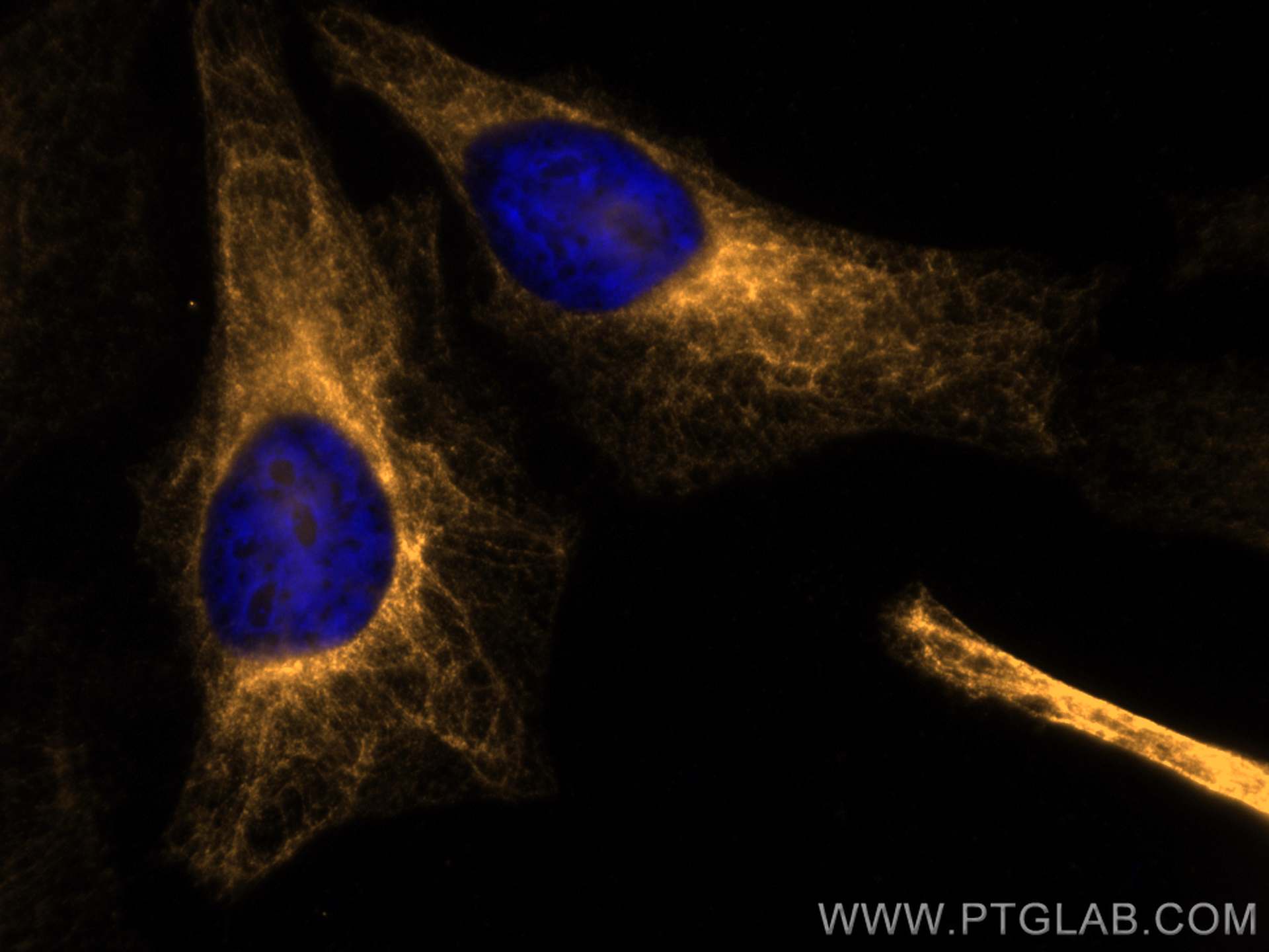 IF Staining of HeLa using CL555-10712