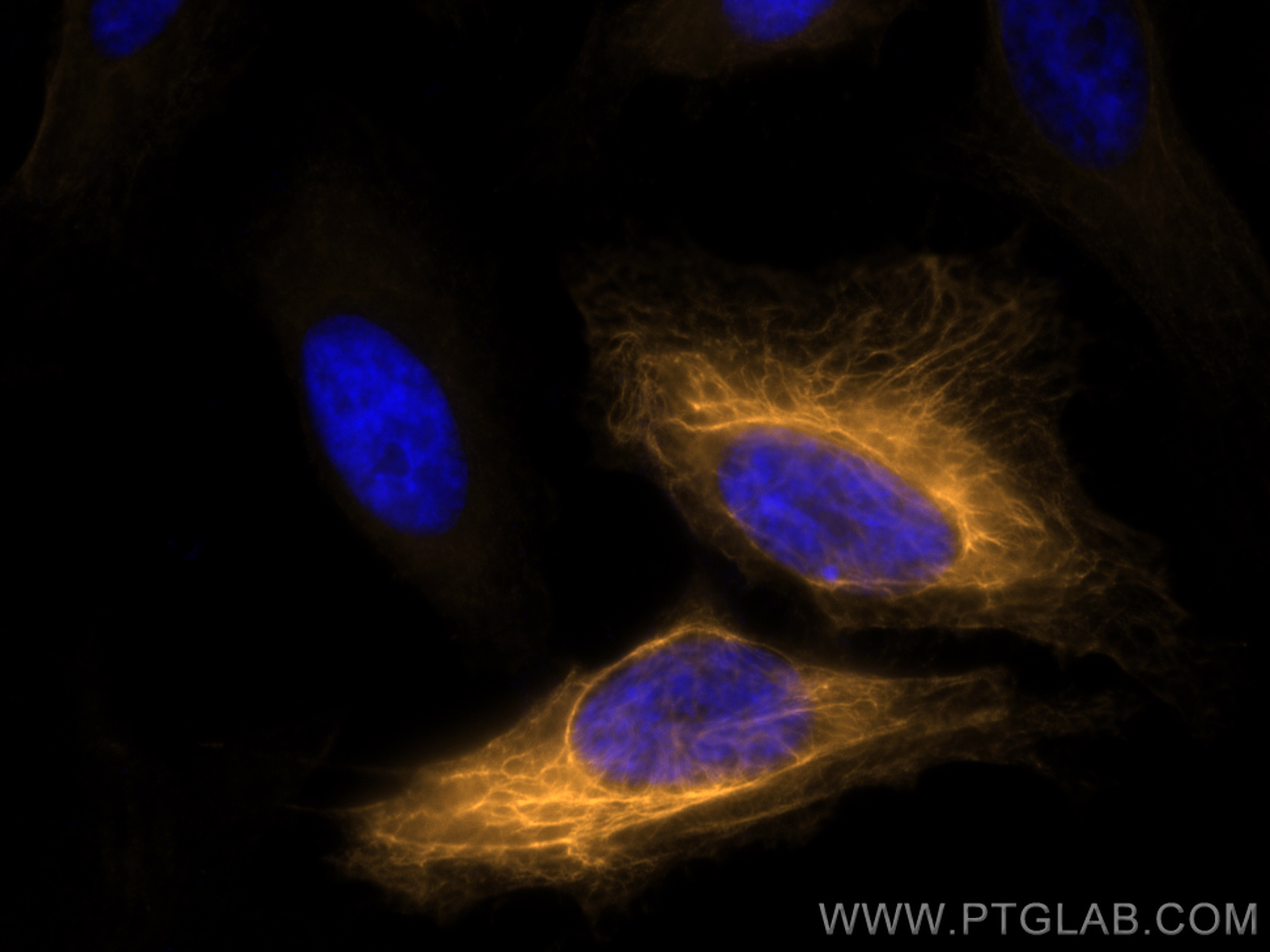 IF Staining of HeLa using CL555-14965