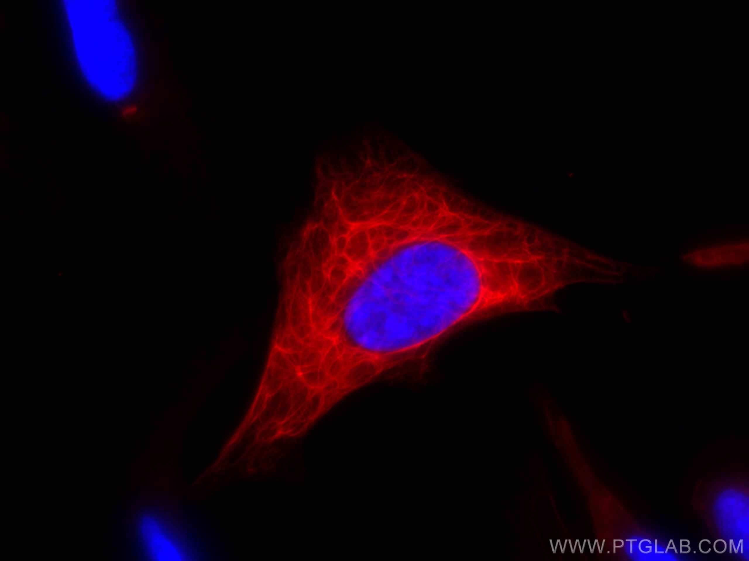 IF Staining of HeLa using CL594-10712