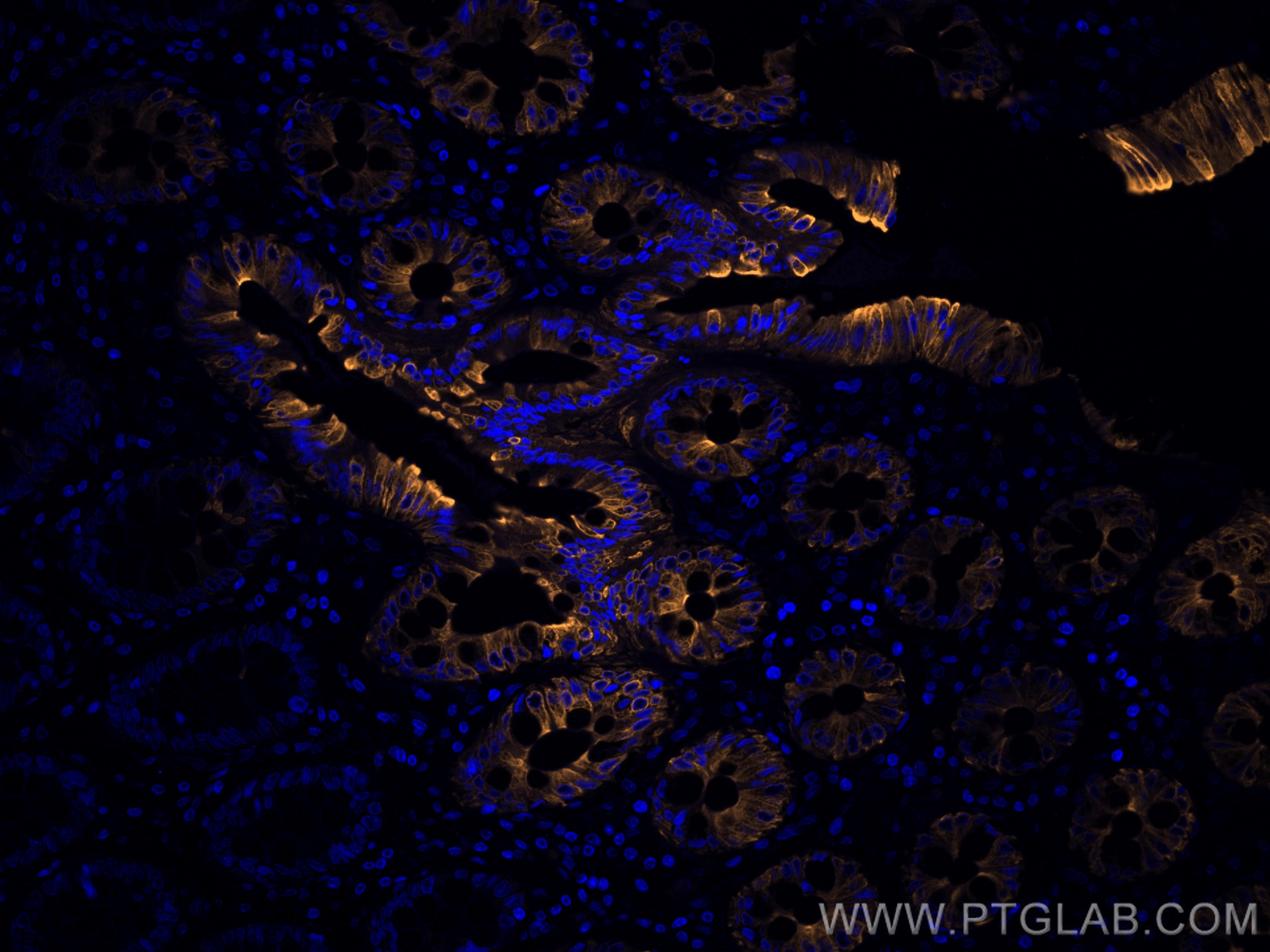 IF Staining of human colon using CL555-60183