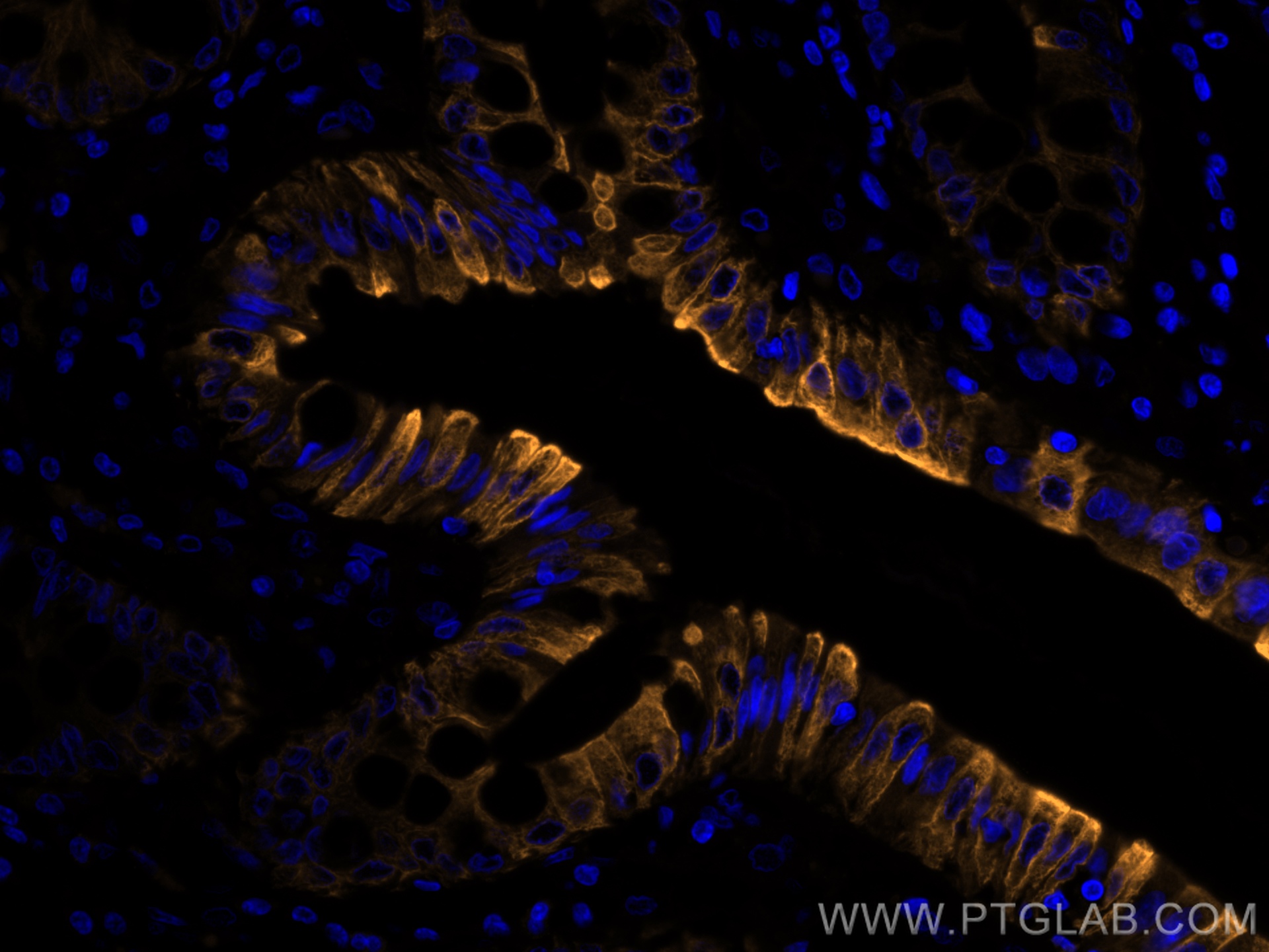 IF Staining of human colon using CL555-60183