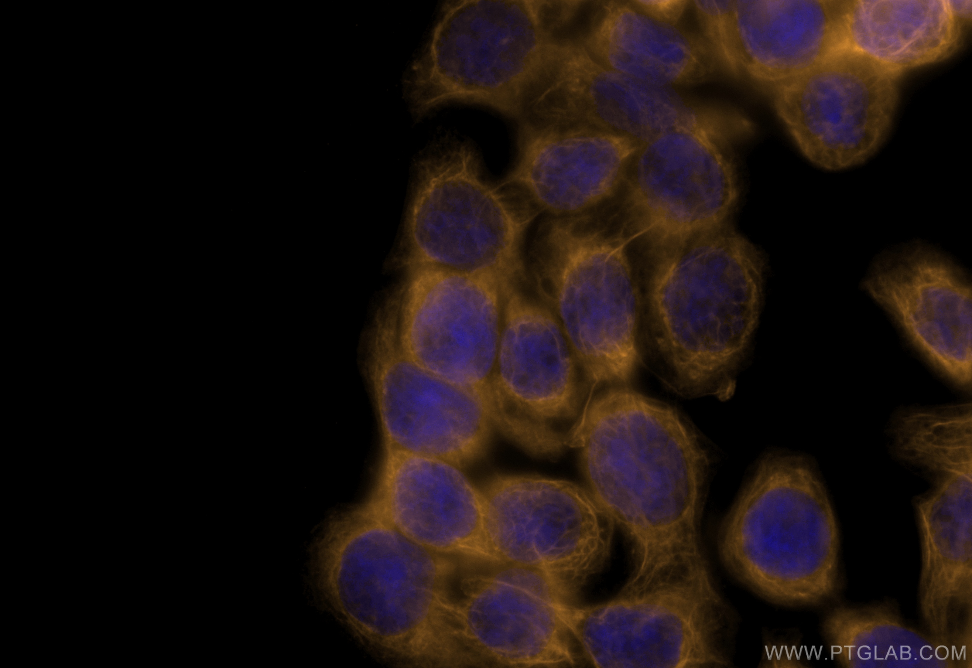 IF Staining of HT-29 using CL555-60183