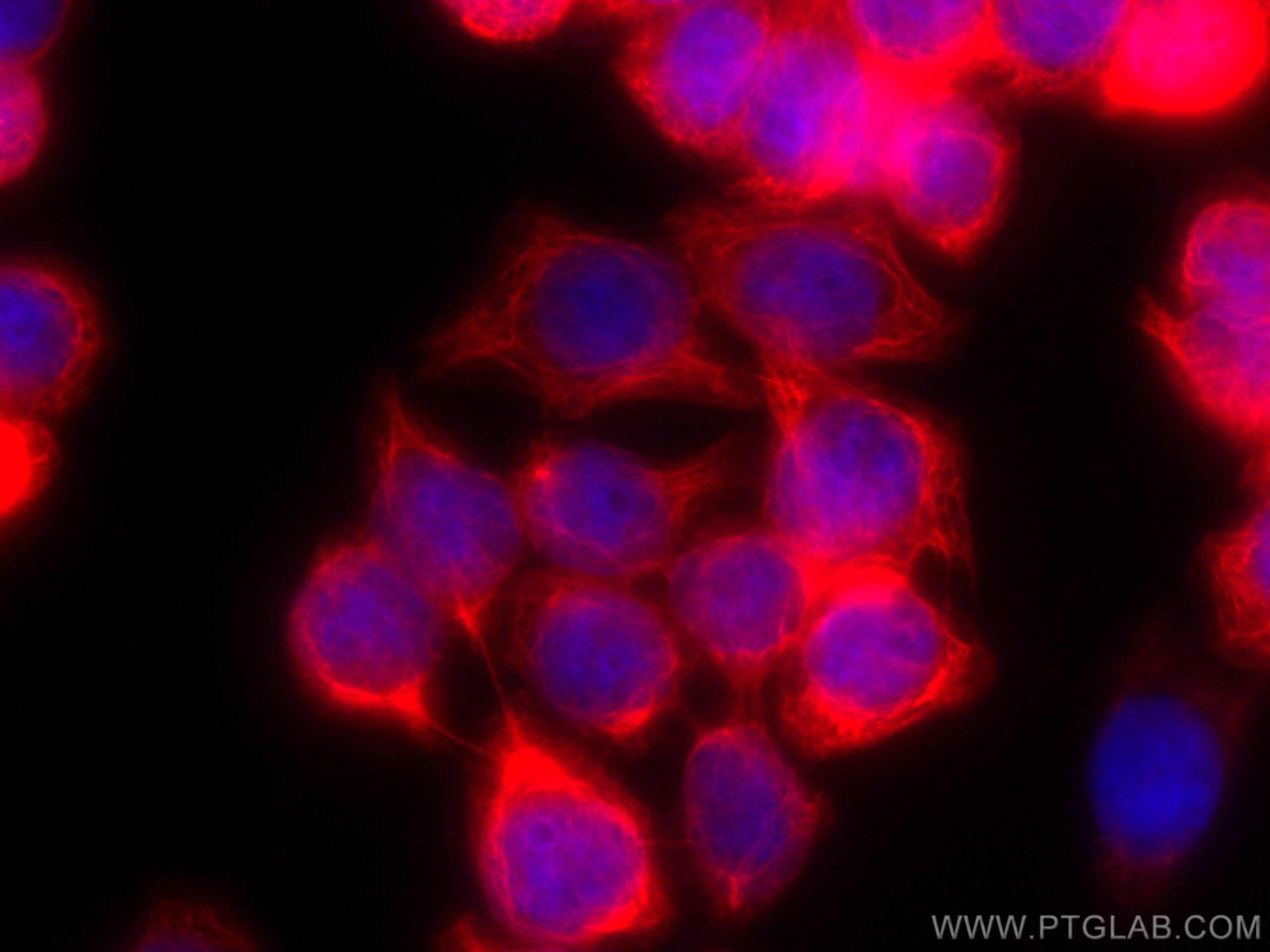 Cytokeratin 20