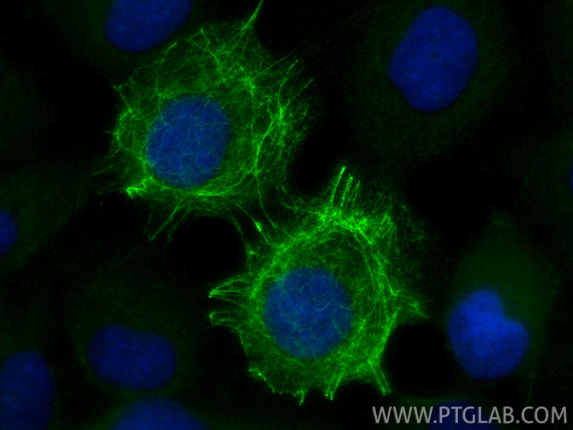 IF Staining of A431 using 33702-1-AP (same clone as 33702-1-PBS)