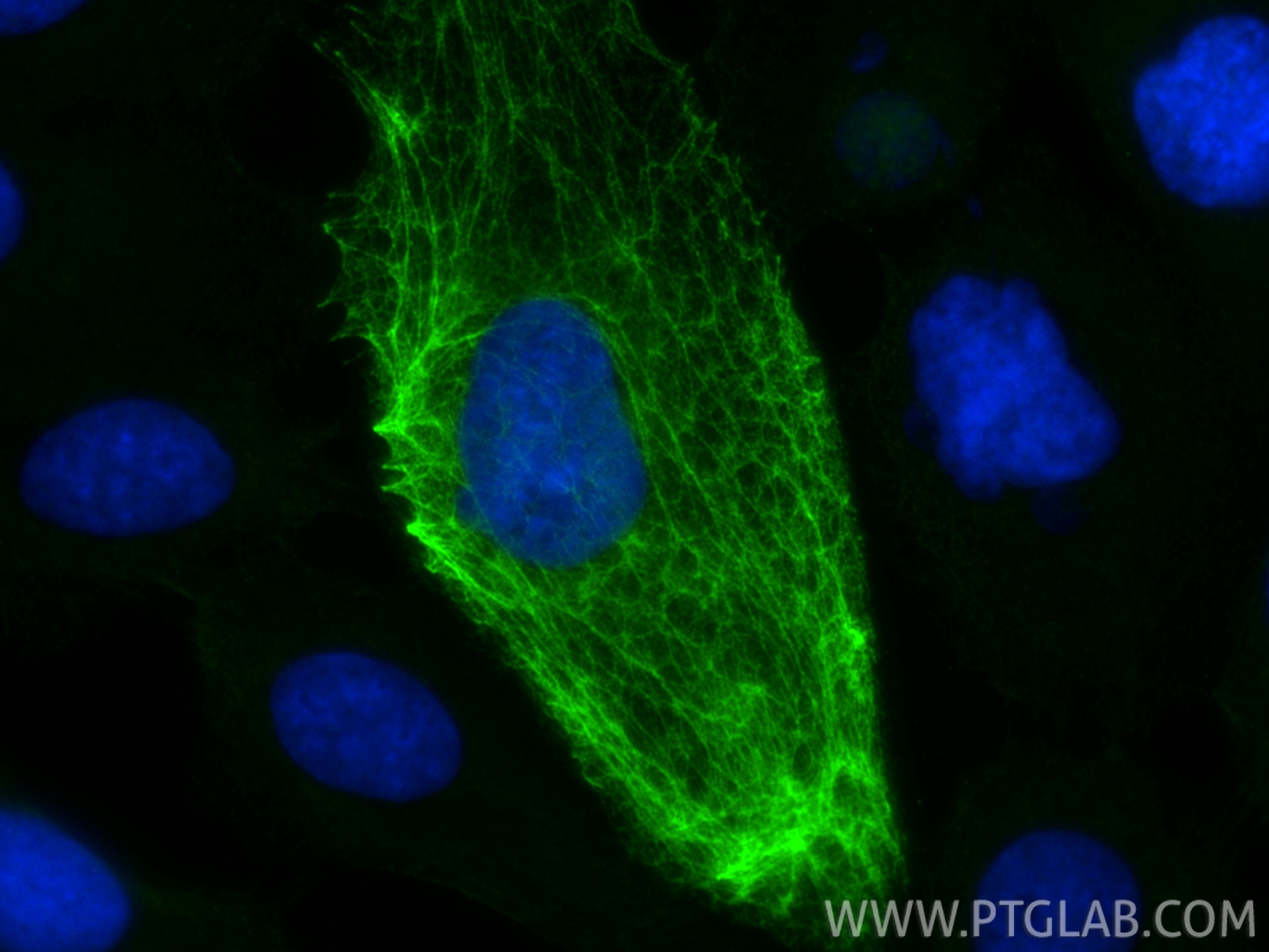 IF Staining of A431 using 33702-1-AP (same clone as 33702-1-PBS)