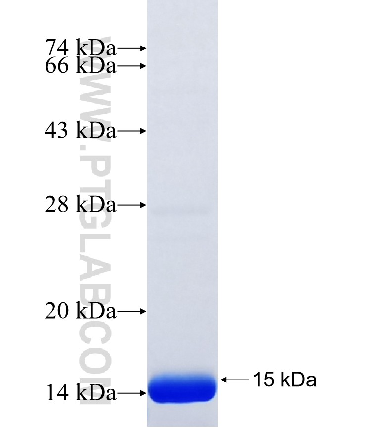 KRT24 fusion protein Ag40490 SDS-PAGE