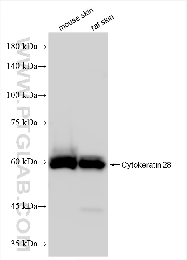 WB analysis of mouse skin using 86434-1-RR